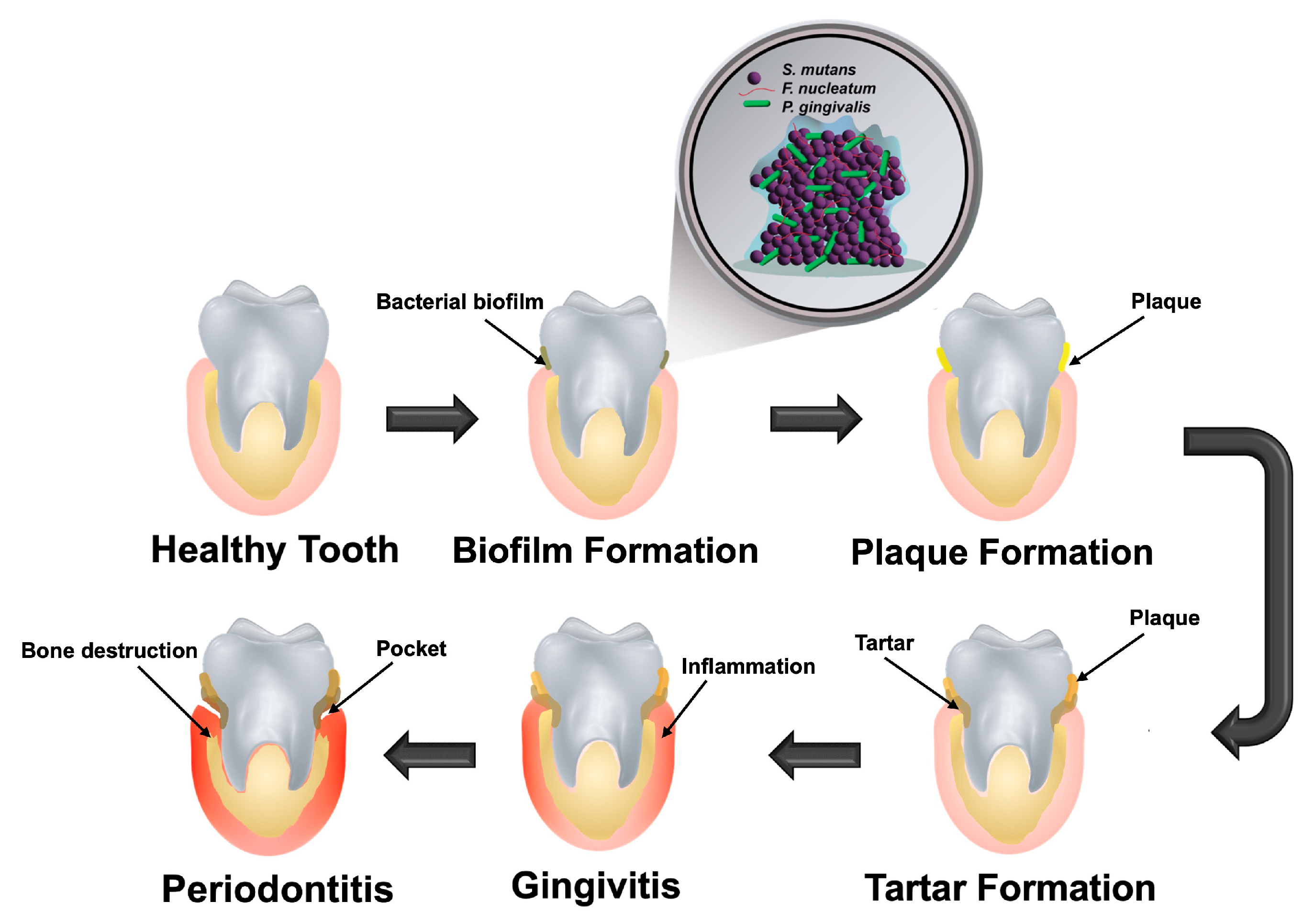 Oral 05 00089 g001 Oral 05 00089 g001