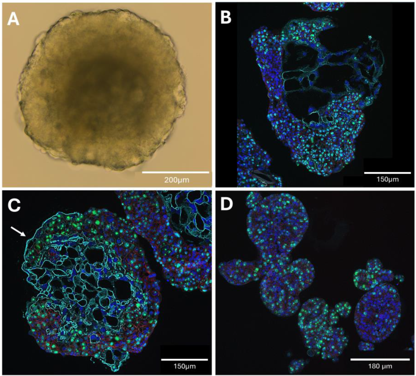 Organoids 04 00024 g004