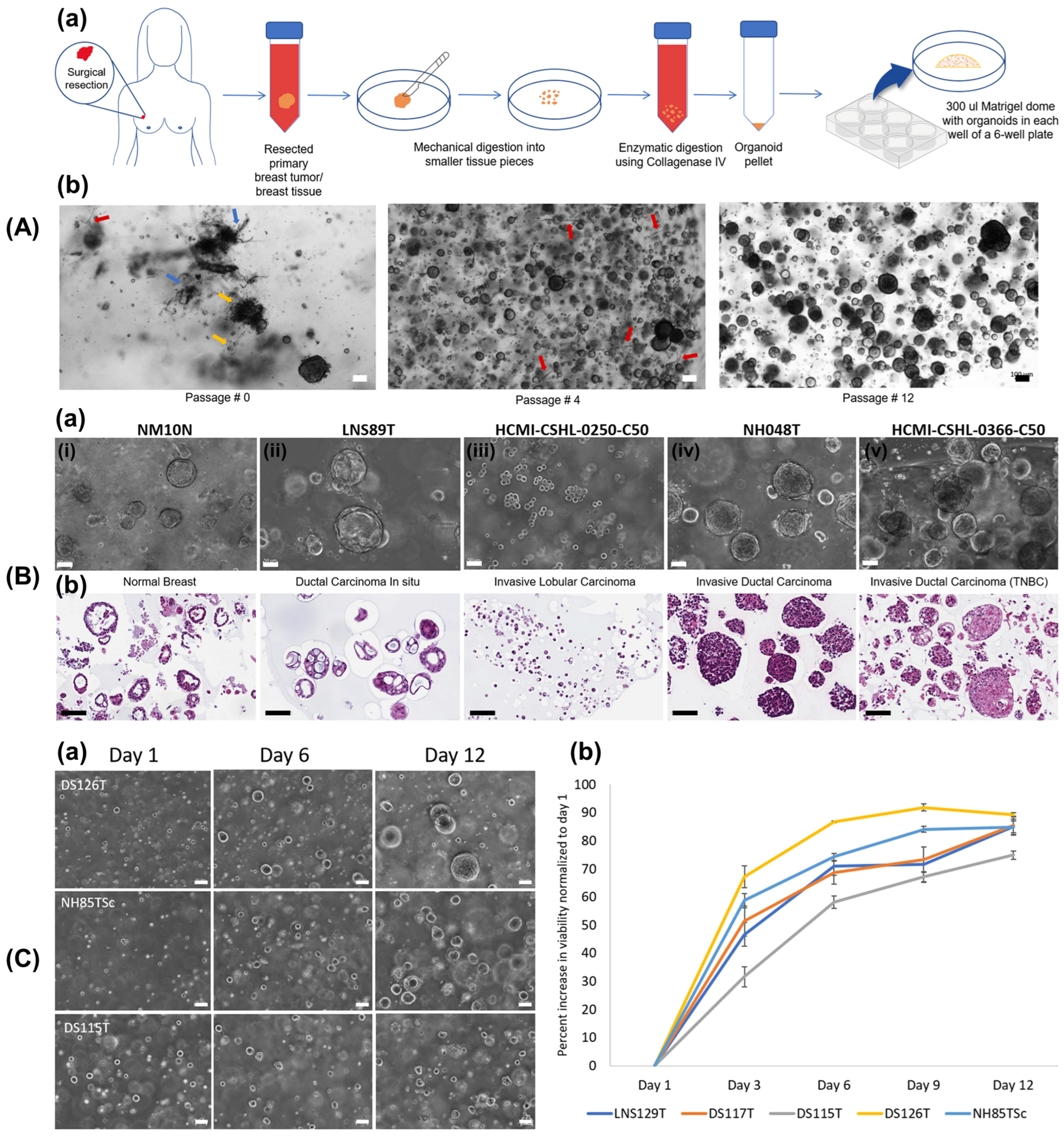 Integrating 3D Bioprinting with Organoid Technology-Based Breast