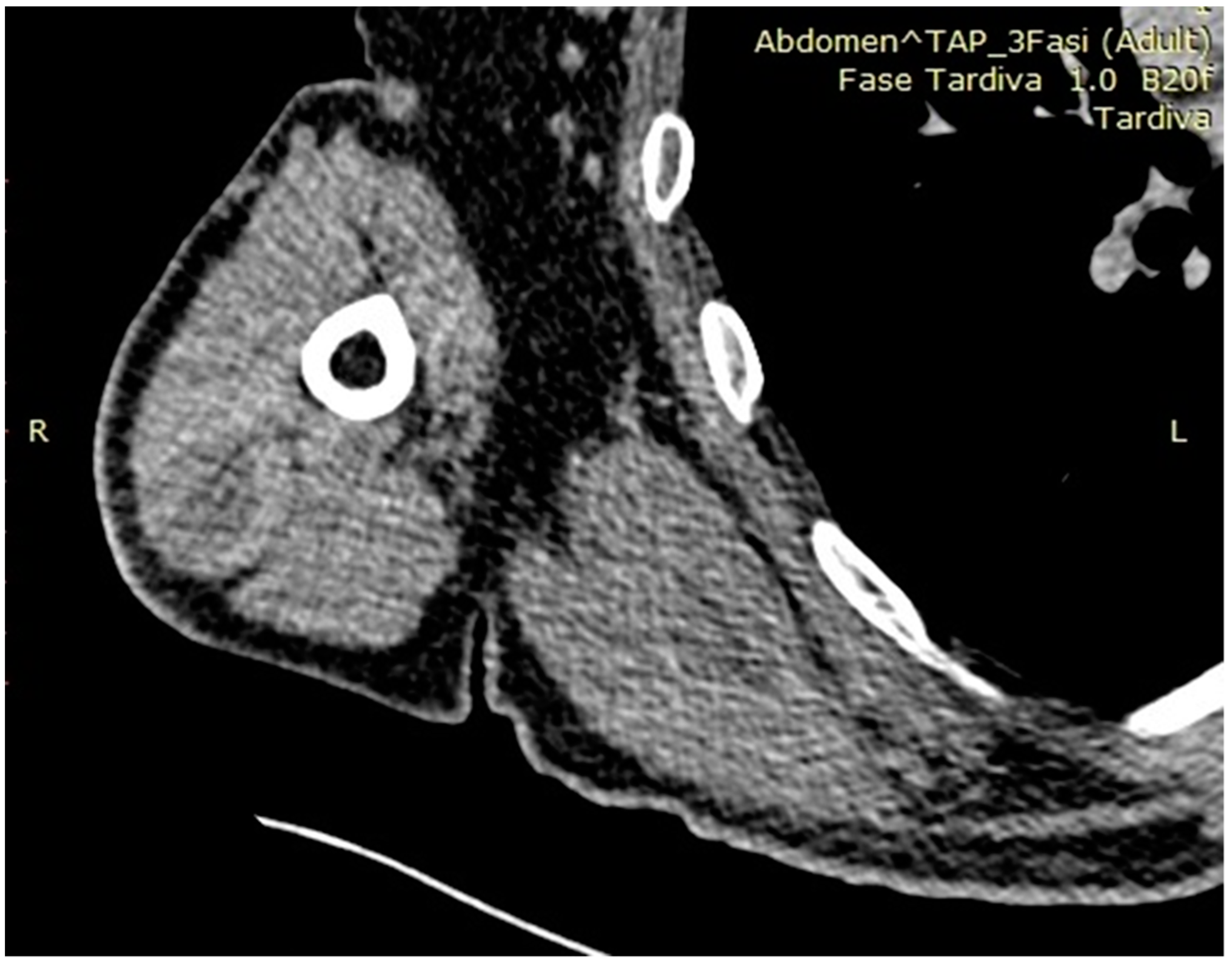 Osteology 01 00012 g001 550