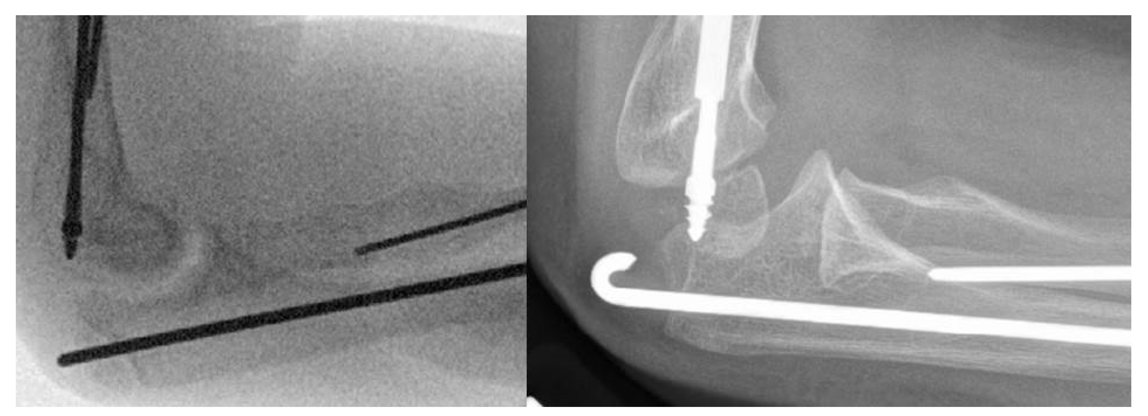 Osteology 02 00003 g003 550