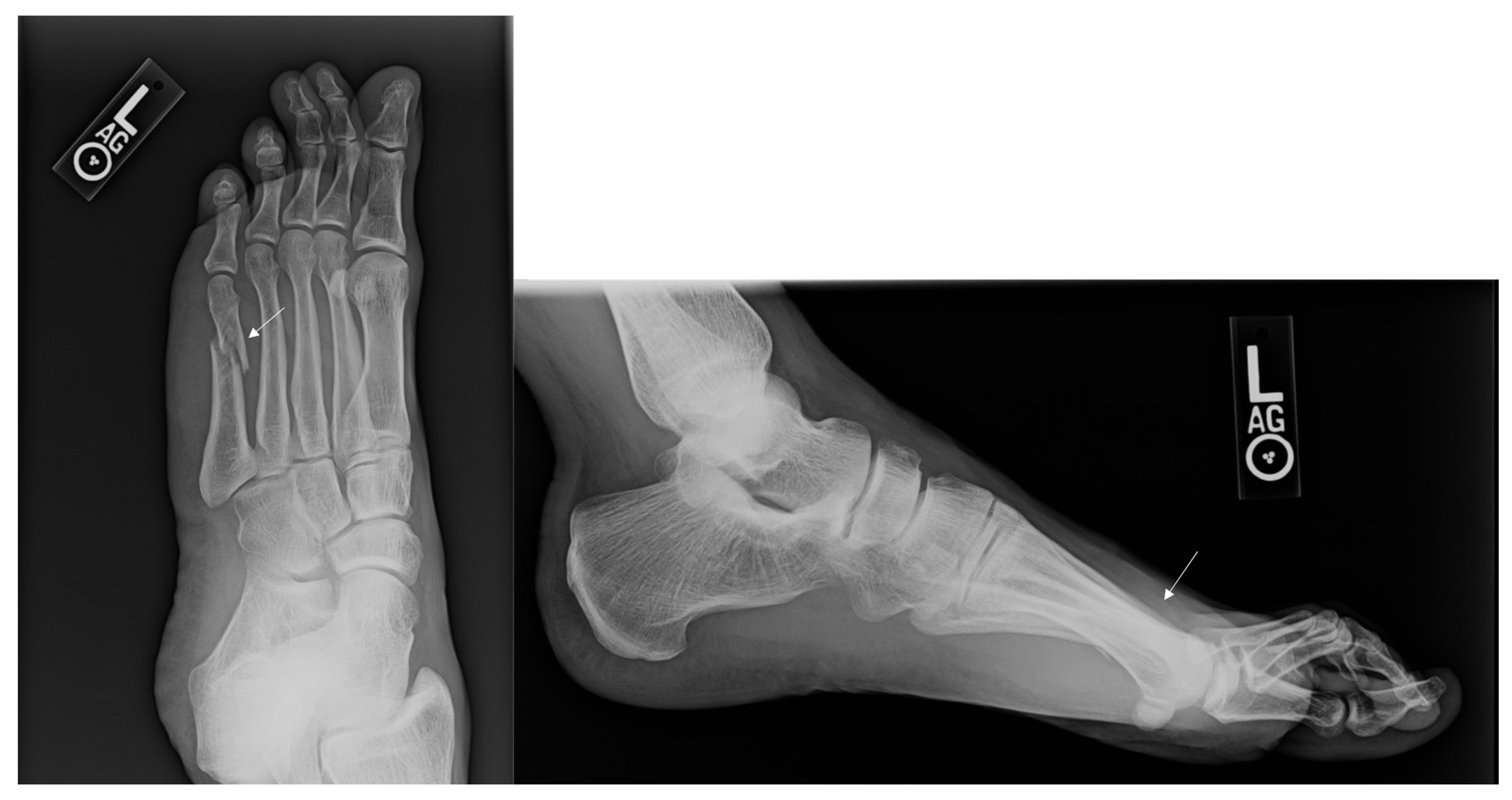 Osteology 02 00009 g003 550