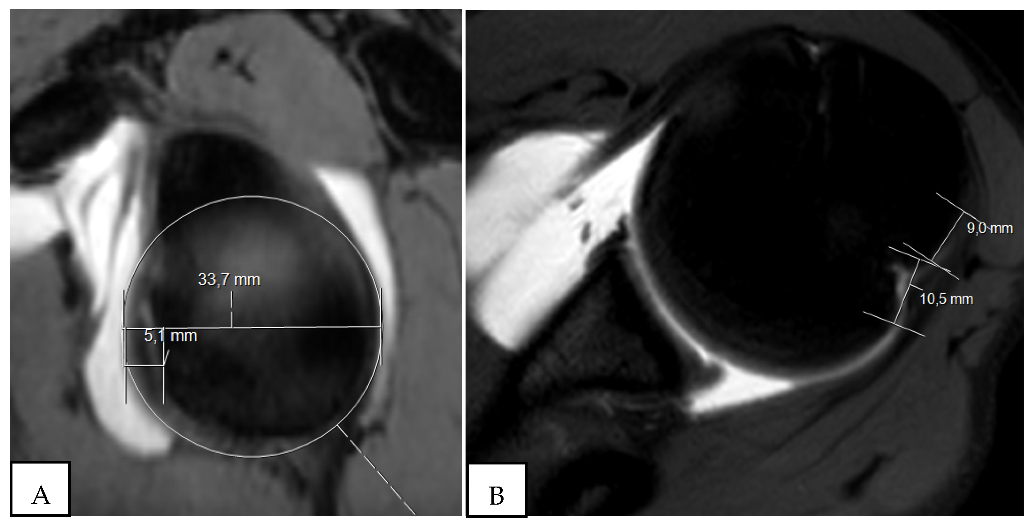 Osteology 02 00015 g004
