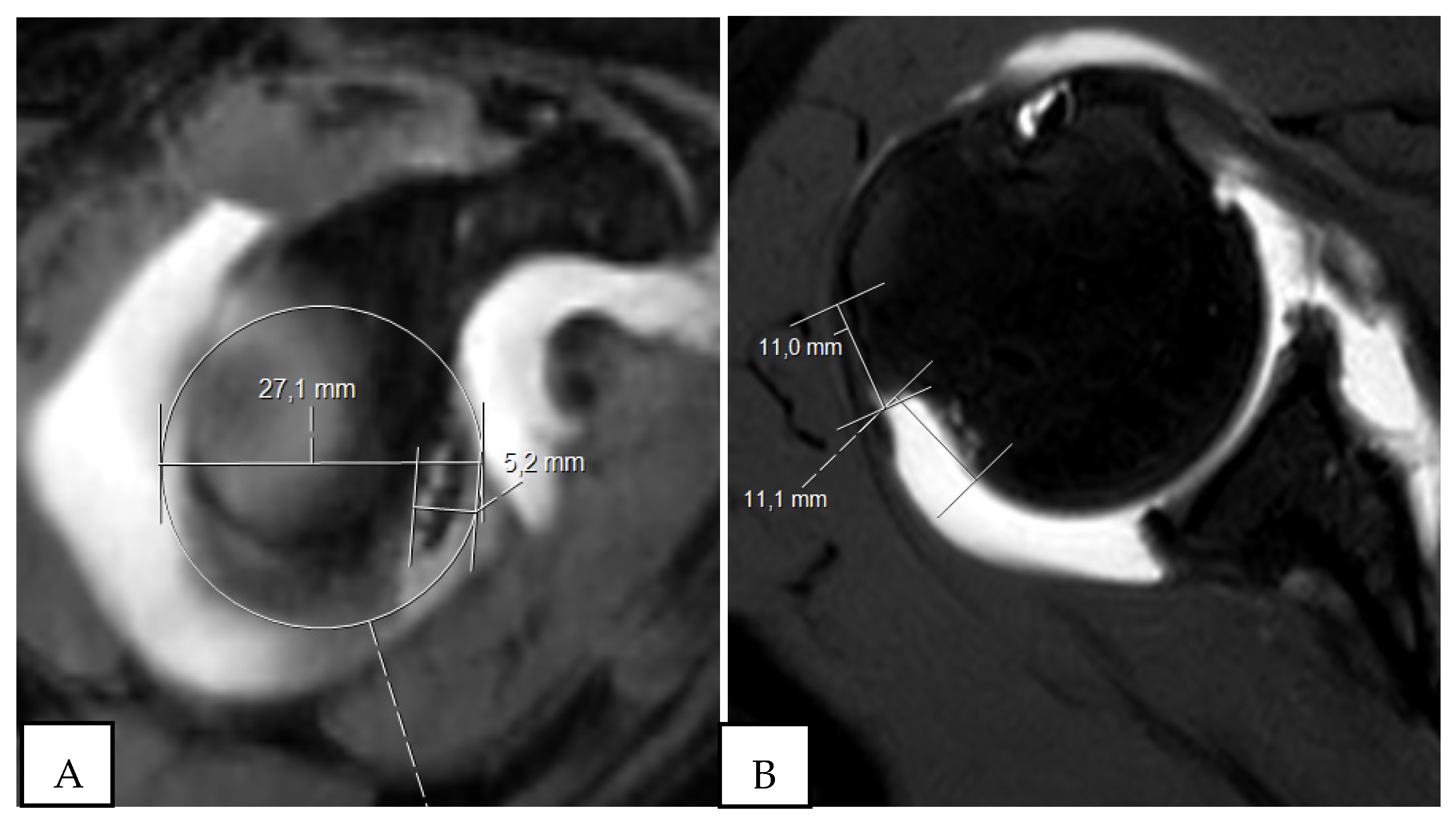 Osteology 02 00015 g005
