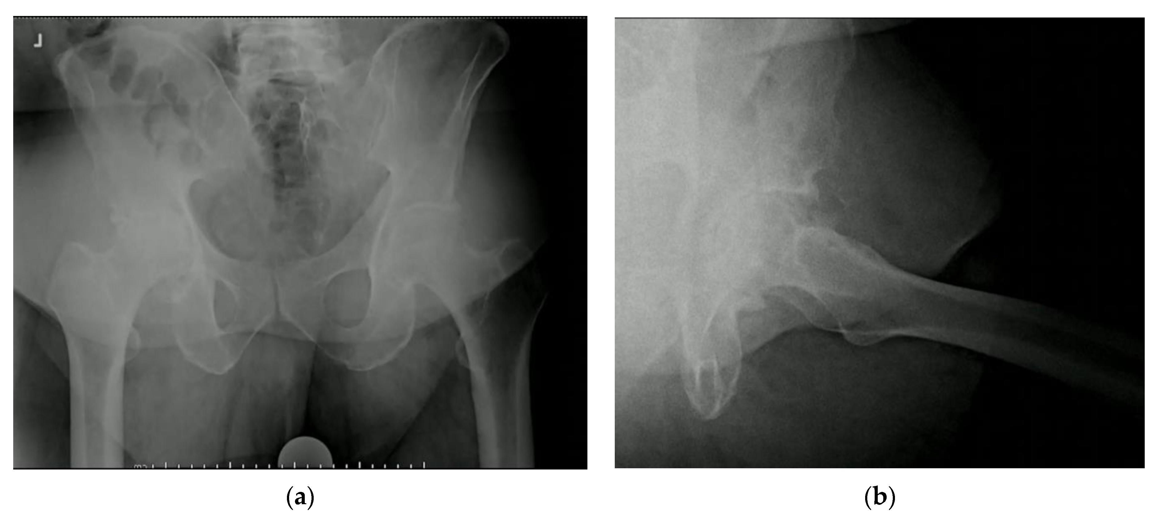 Osteology 03 00005 g002