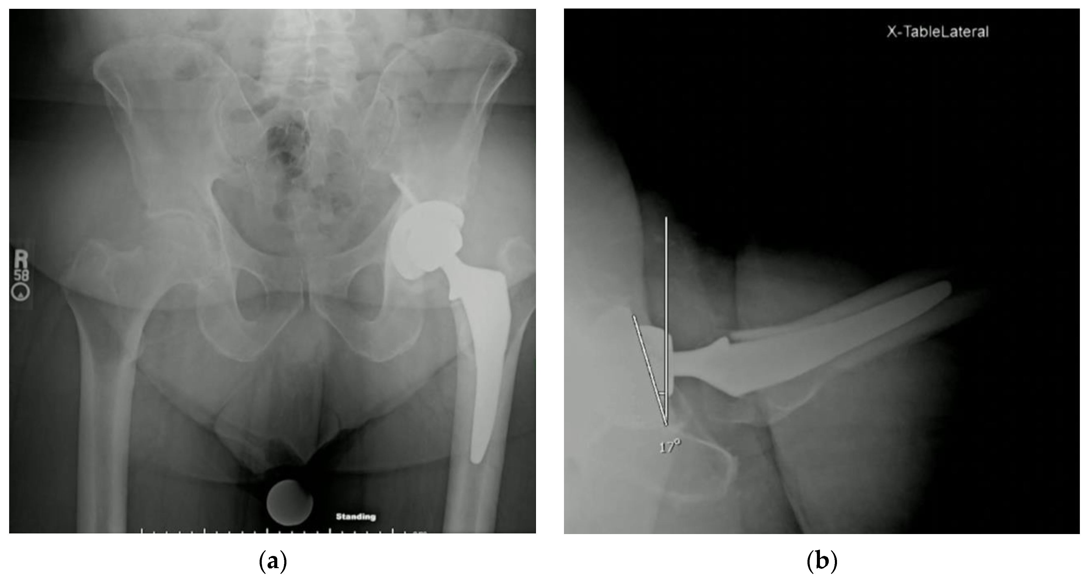 Osteology 03 00005 g004