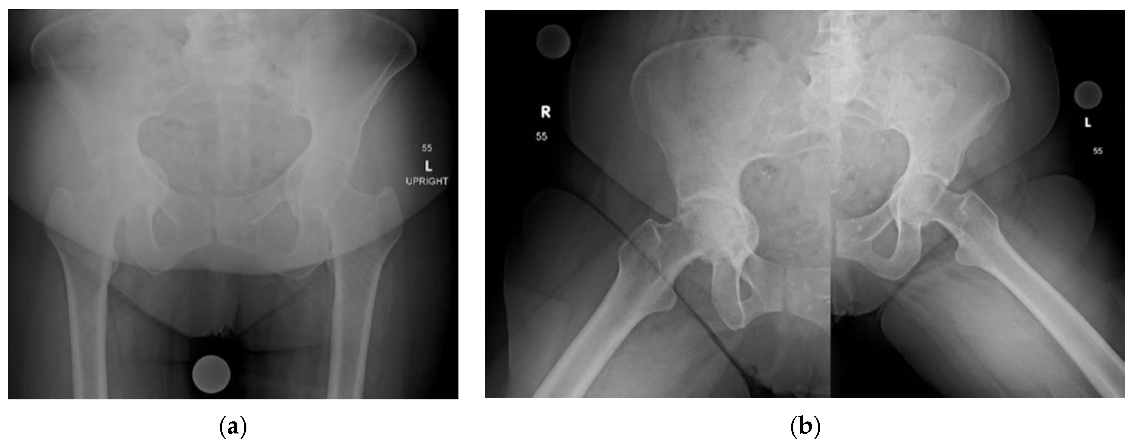 Osteology 03 00005 g005