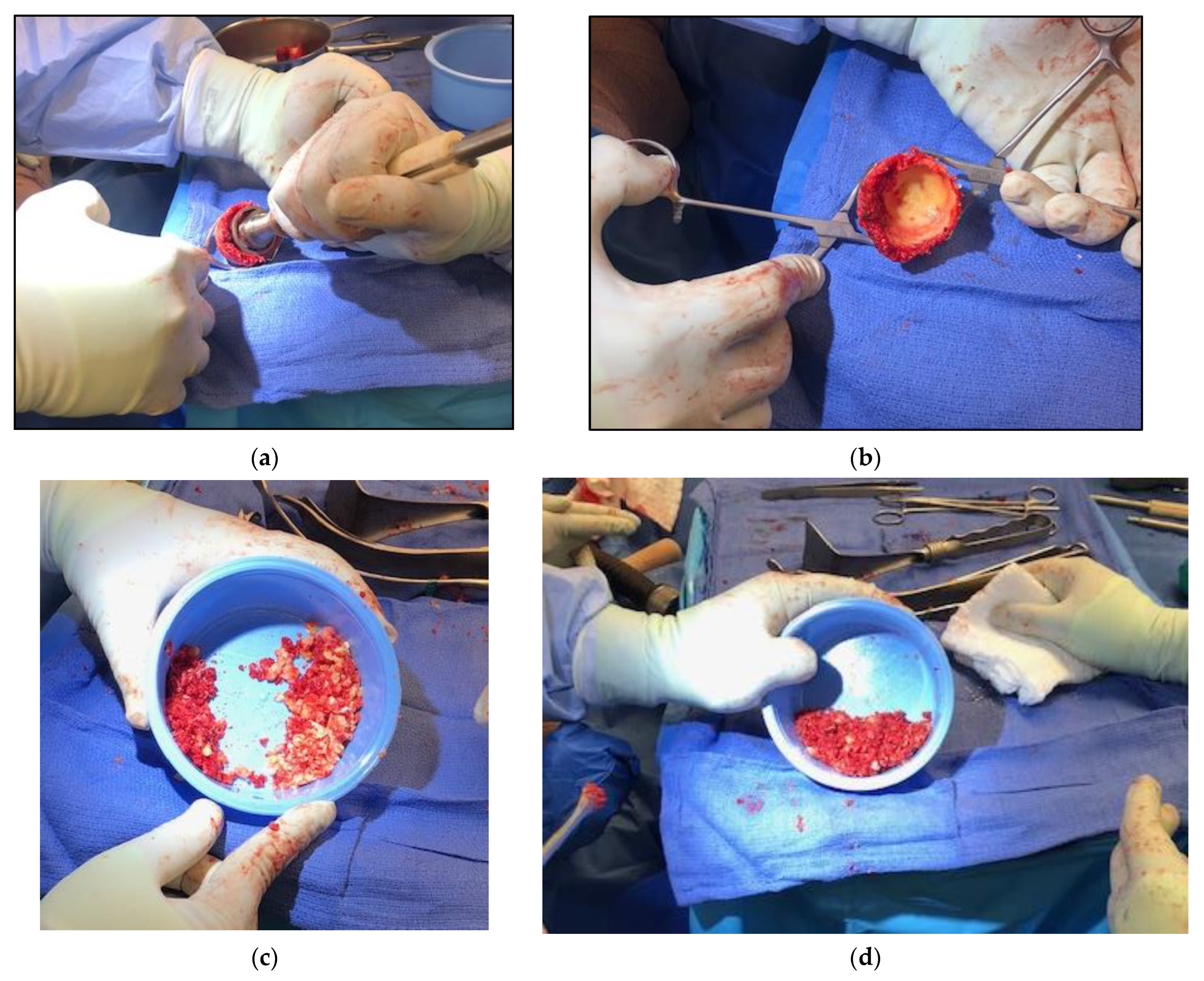 Osteology 03 00005 g006