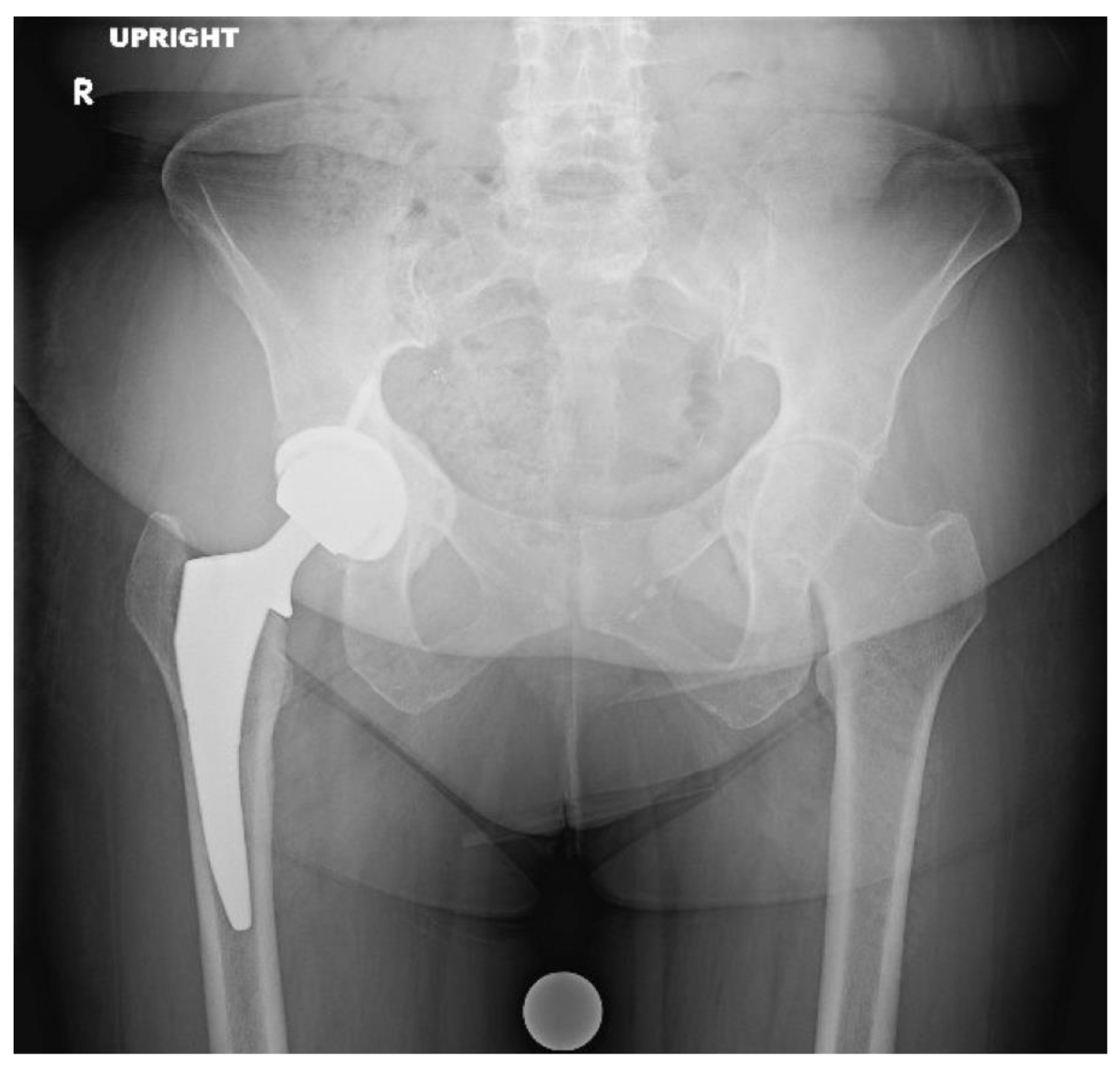Osteology 03 00005 g008