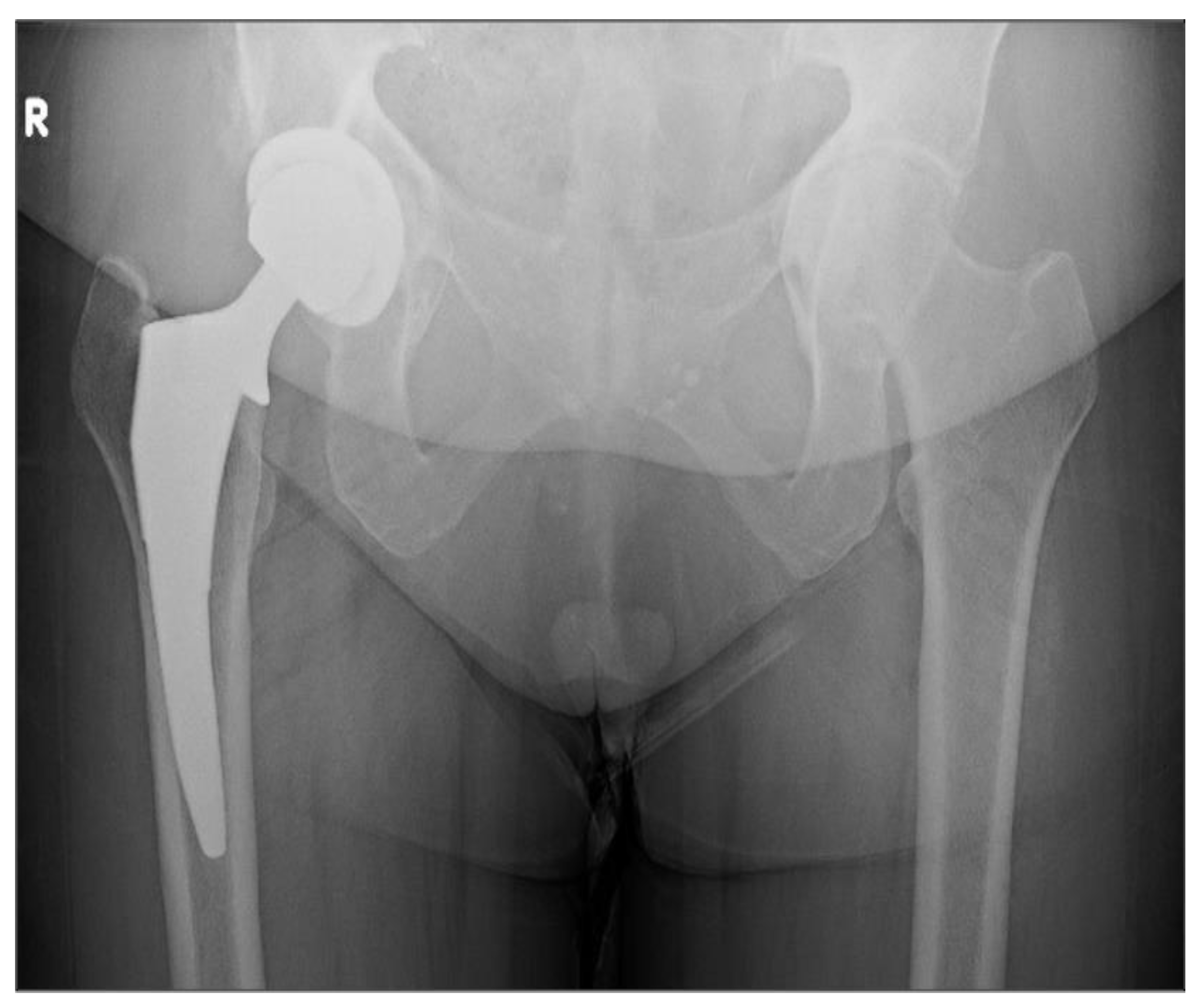 Osteology 03 00005 g009