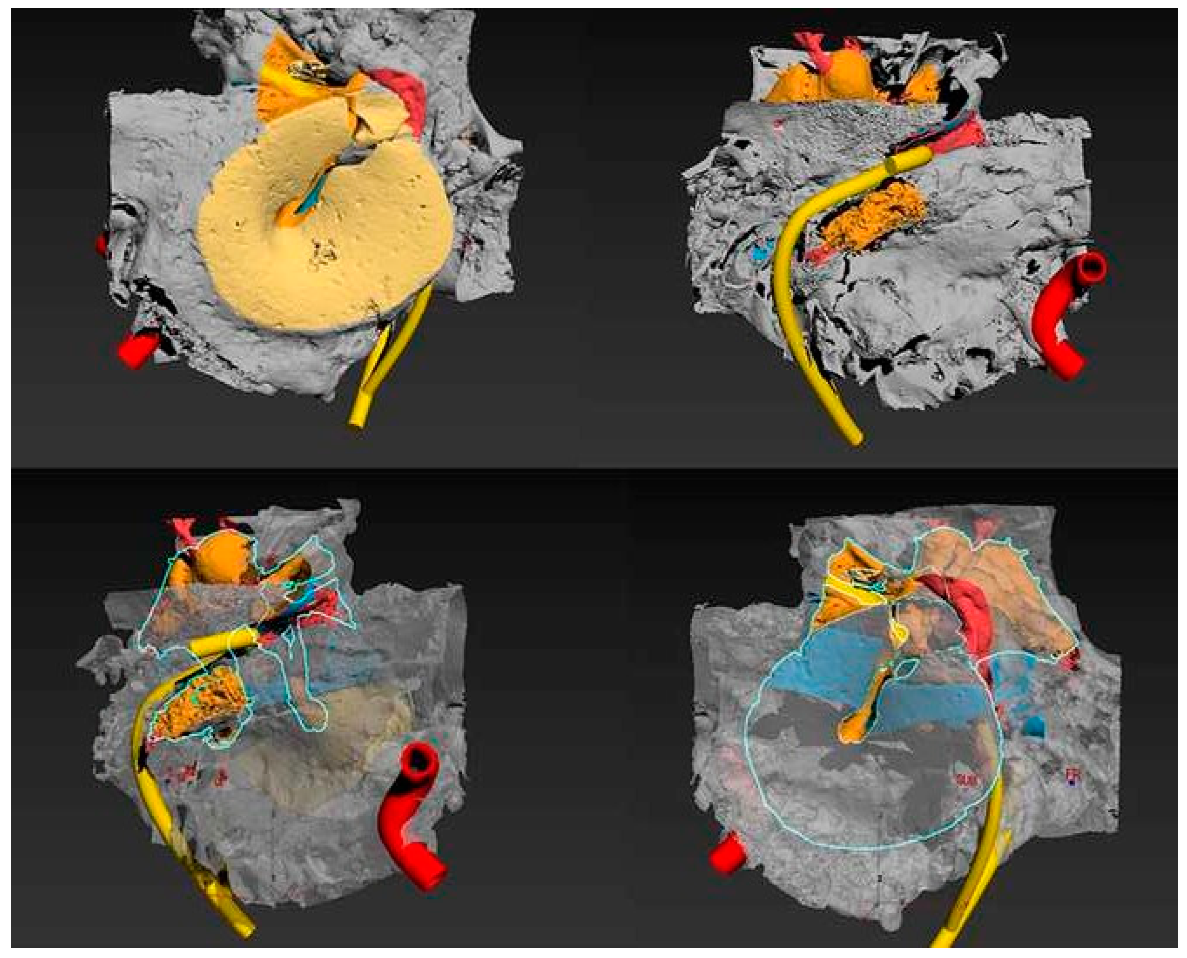 Osteology 03 00007 g004 Osteology 03 00007 g004