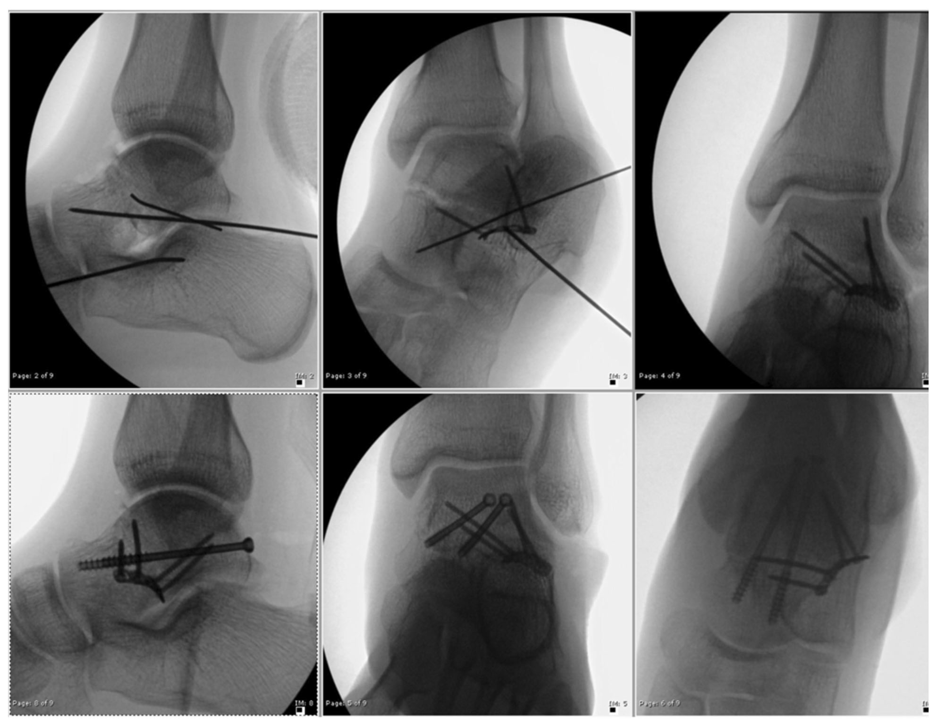 Osteology 03 00013 g004