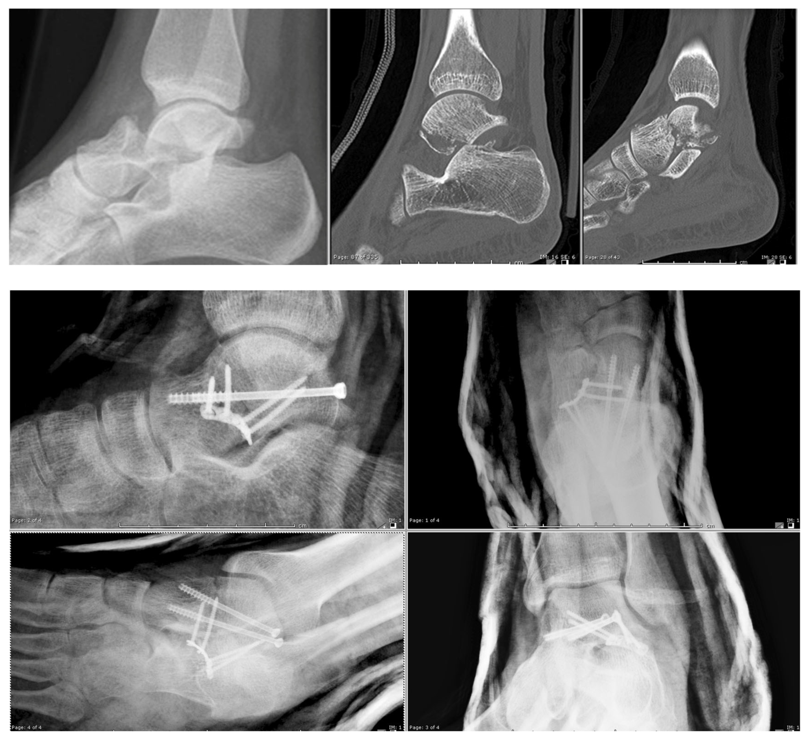 Osteology 03 00013 g005