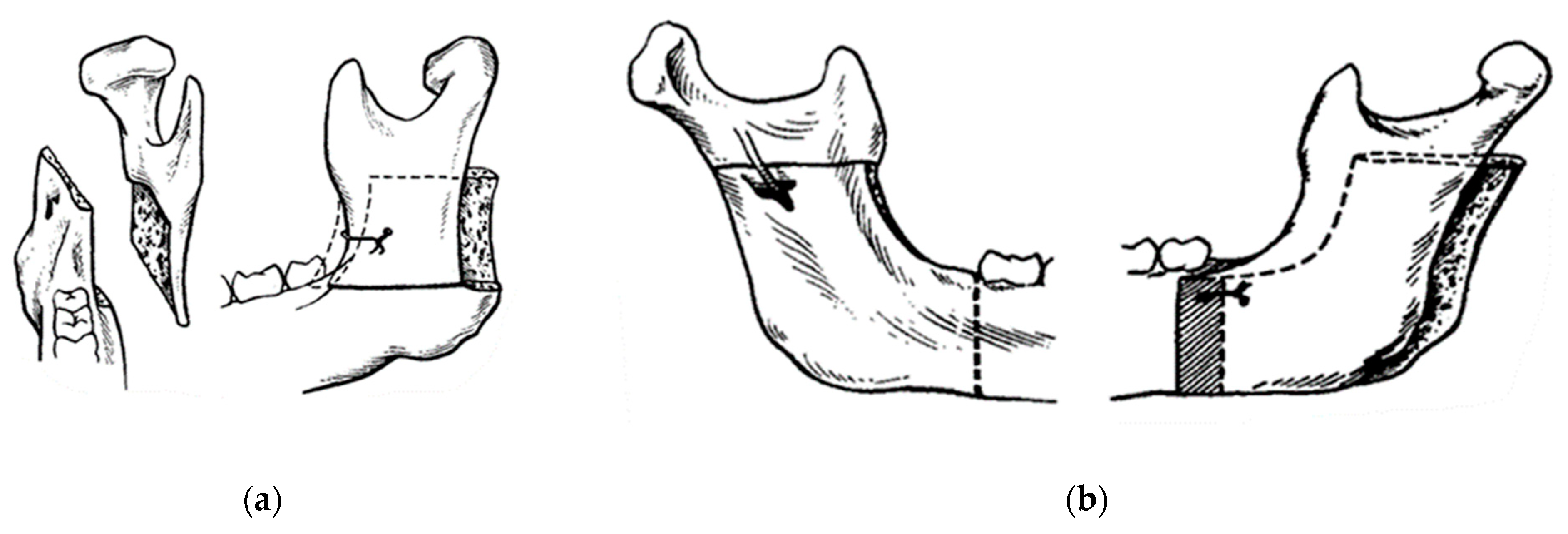 Osteology 04 00002 g005 Osteology 04 00002 g005