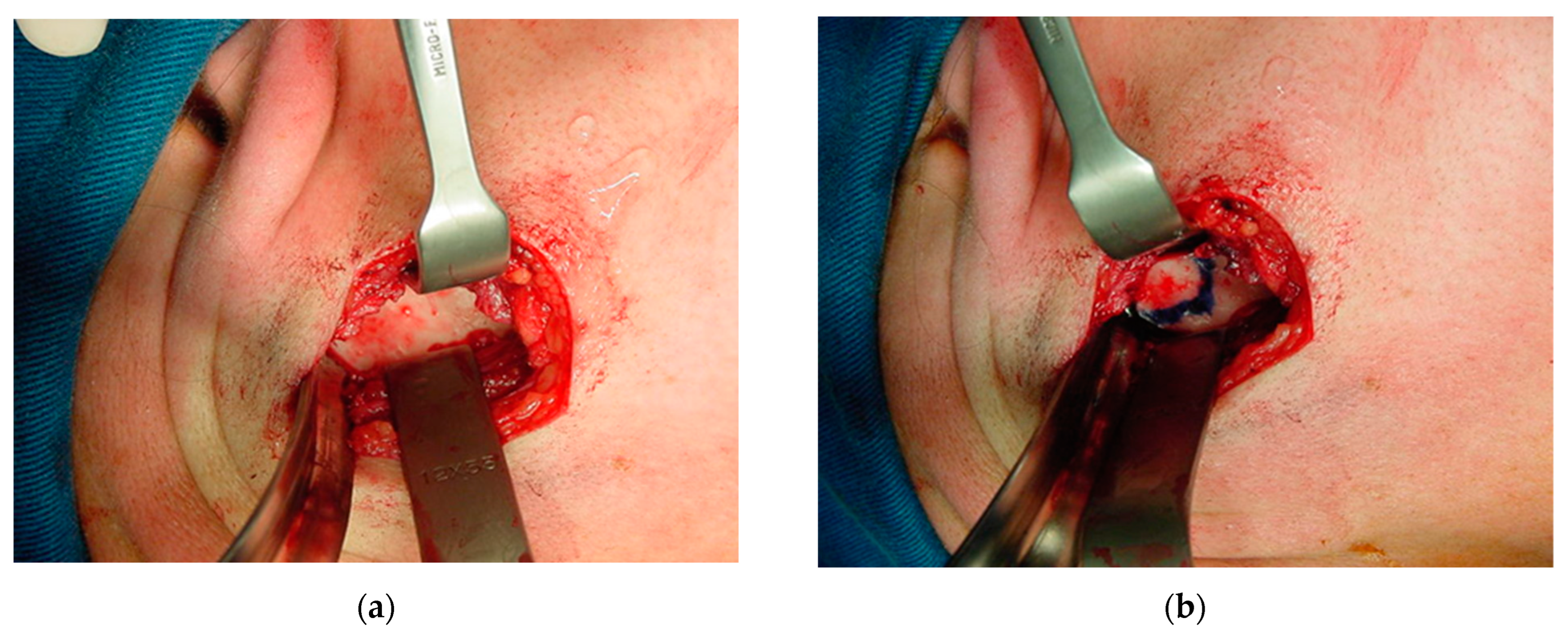 Osteology 04 00002 g012 Osteology 04 00002 g012