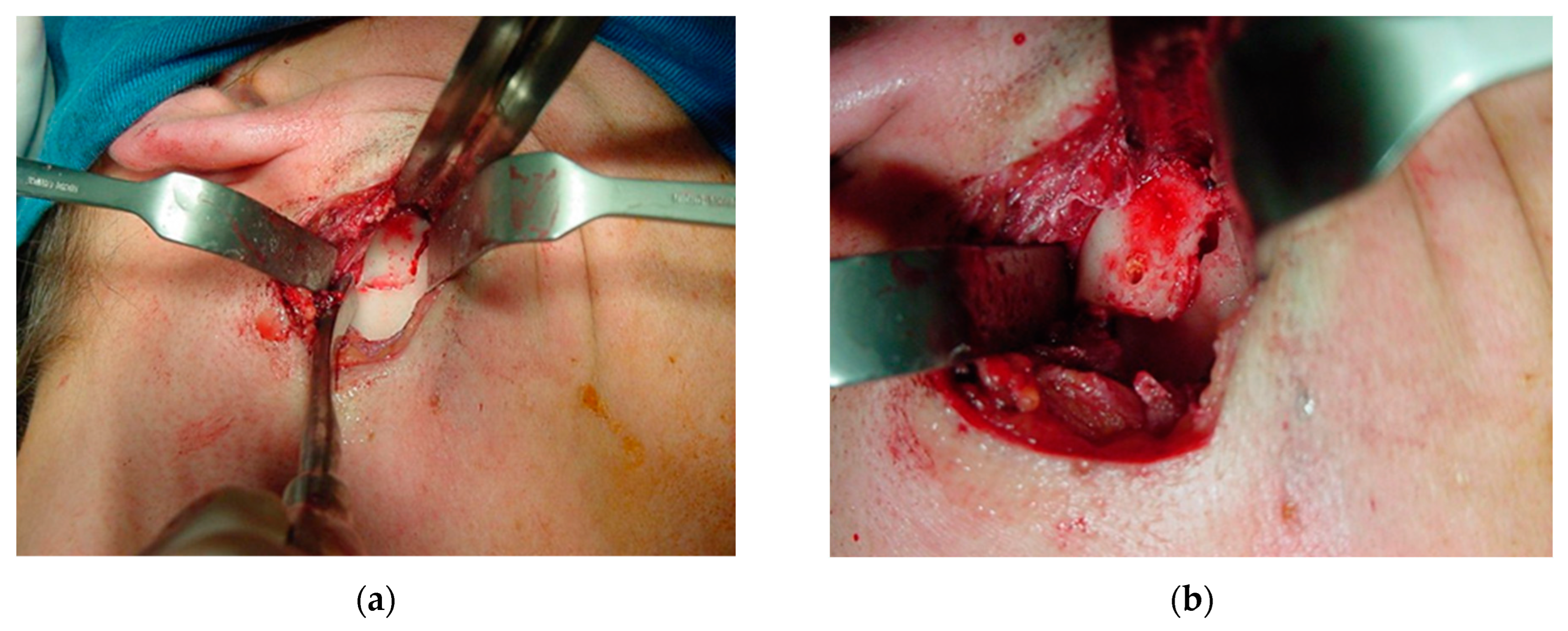 Osteology 04 00002 g013 Osteology 04 00002 g013