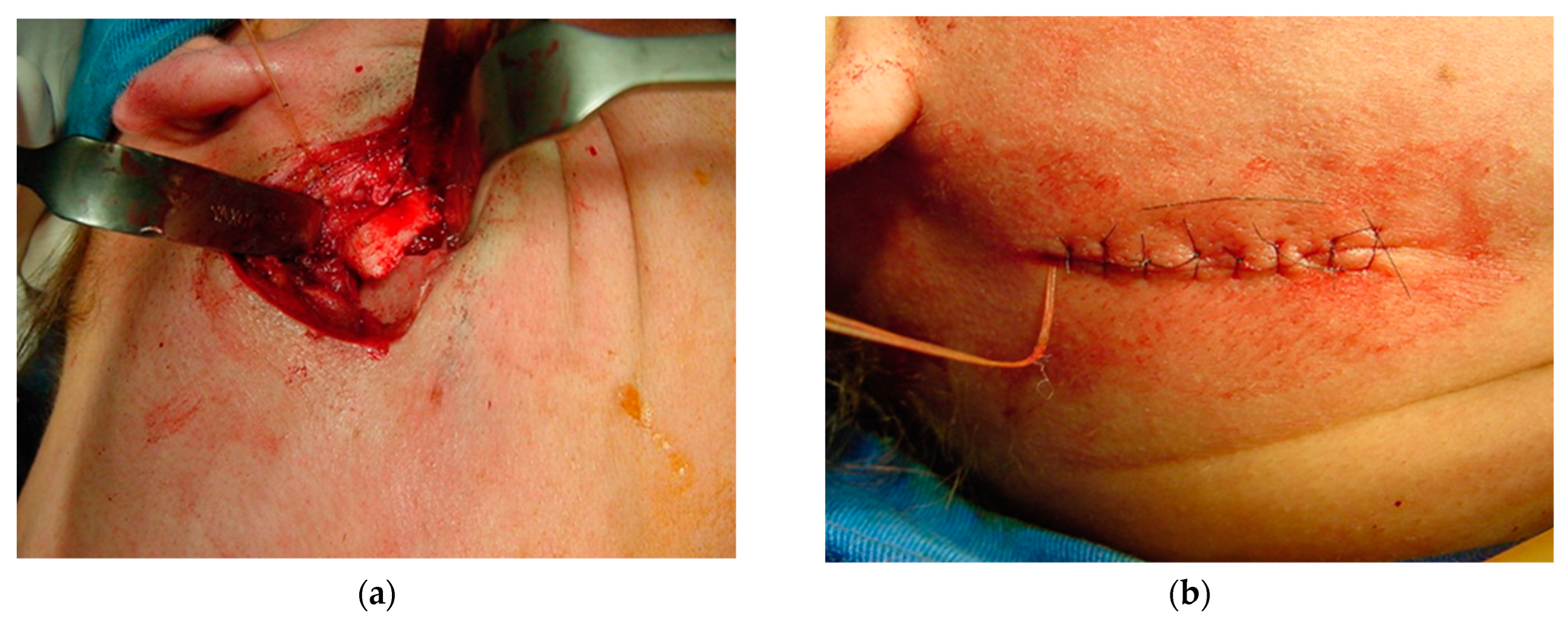 Osteology 04 00002 g014 Osteology 04 00002 g014