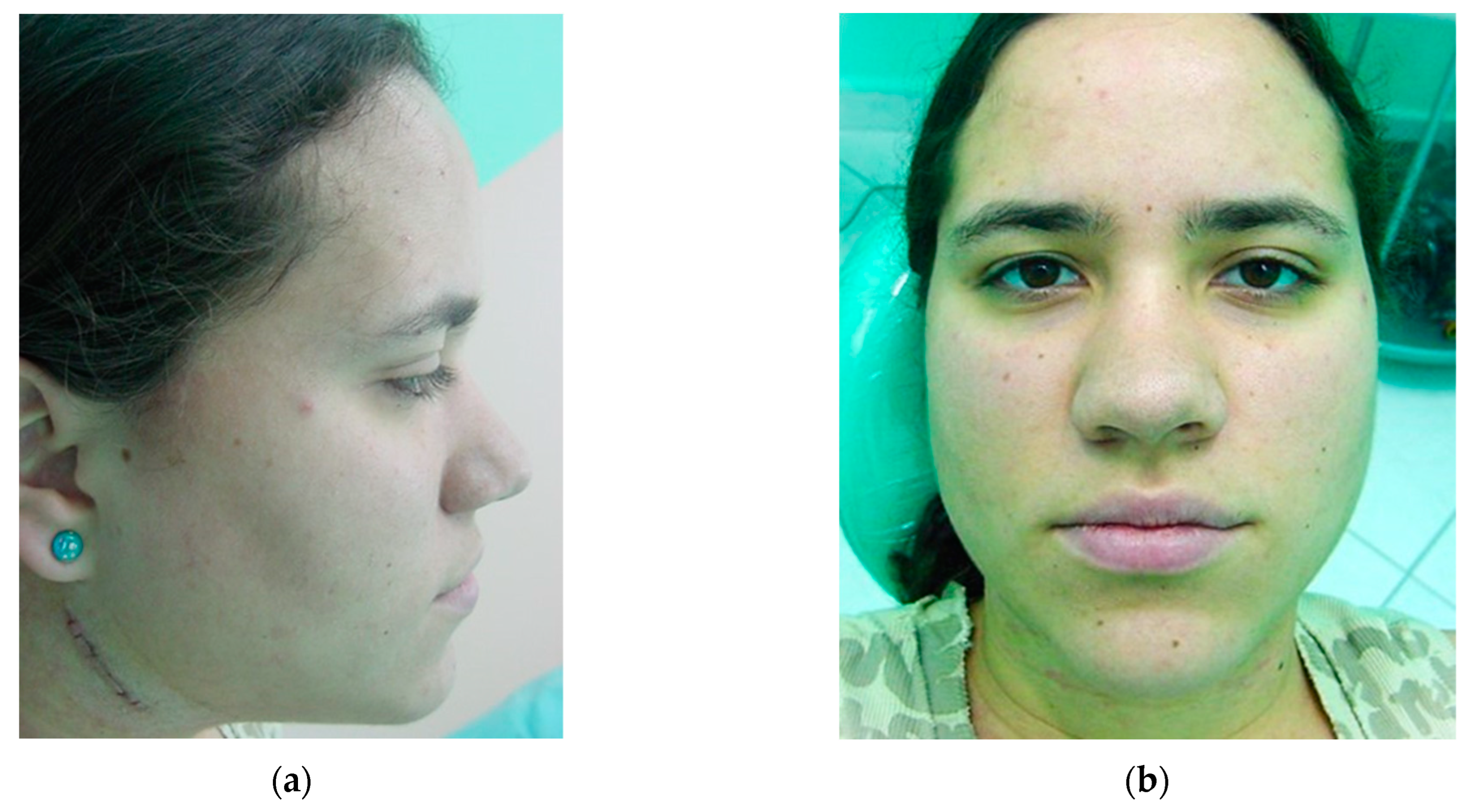 Osteology 04 00002 g017 Osteology 04 00002 g017