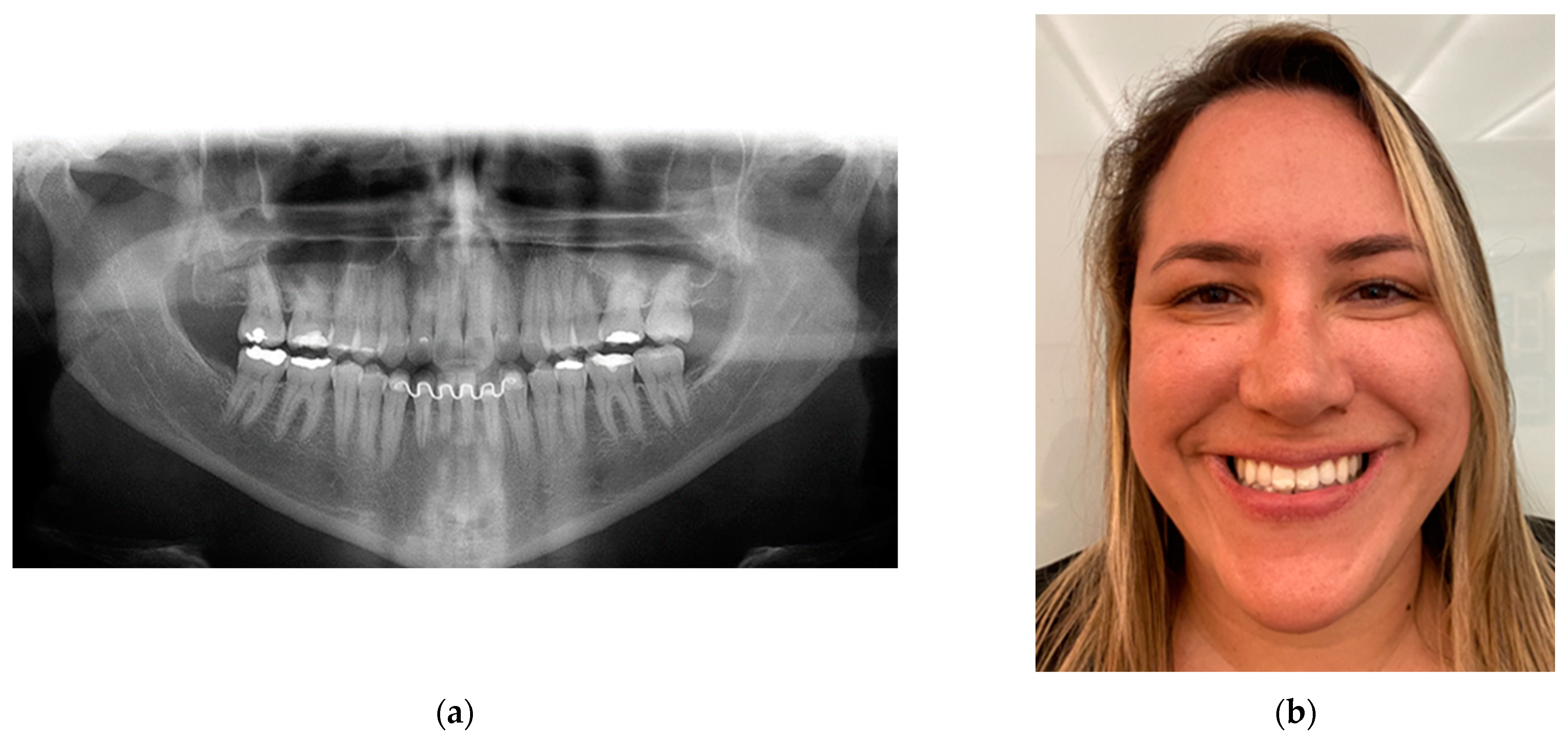 Osteology 04 00002 g019 Osteology 04 00002 g019