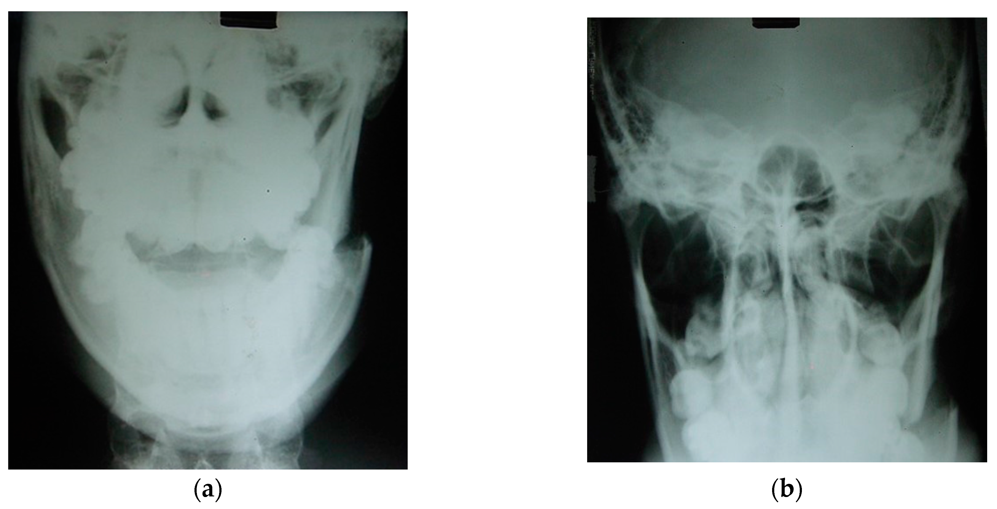 Osteology 04 00002 g020 Osteology 04 00002 g020