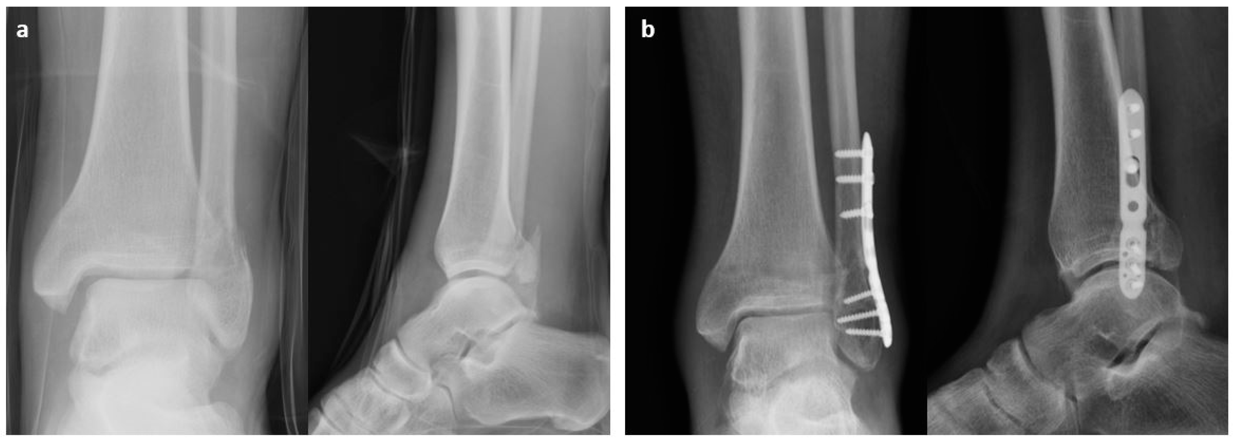 Osteology 04 00012 g001
