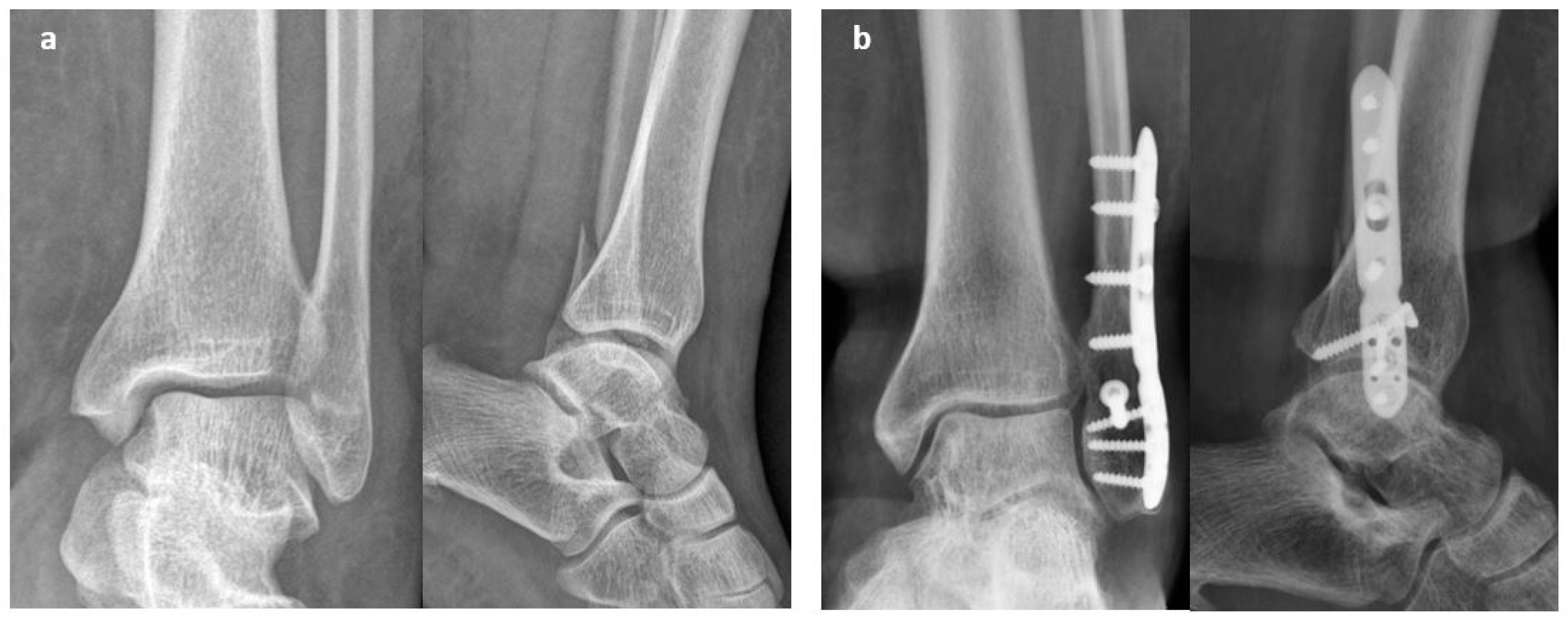 Osteology 04 00012 g002