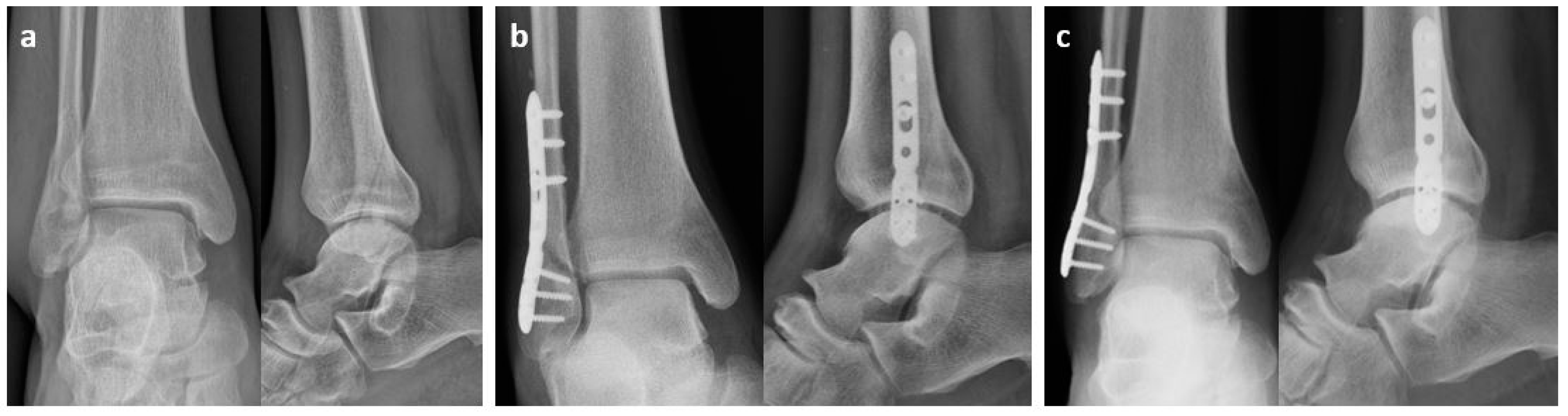 Osteology 04 00012 g003