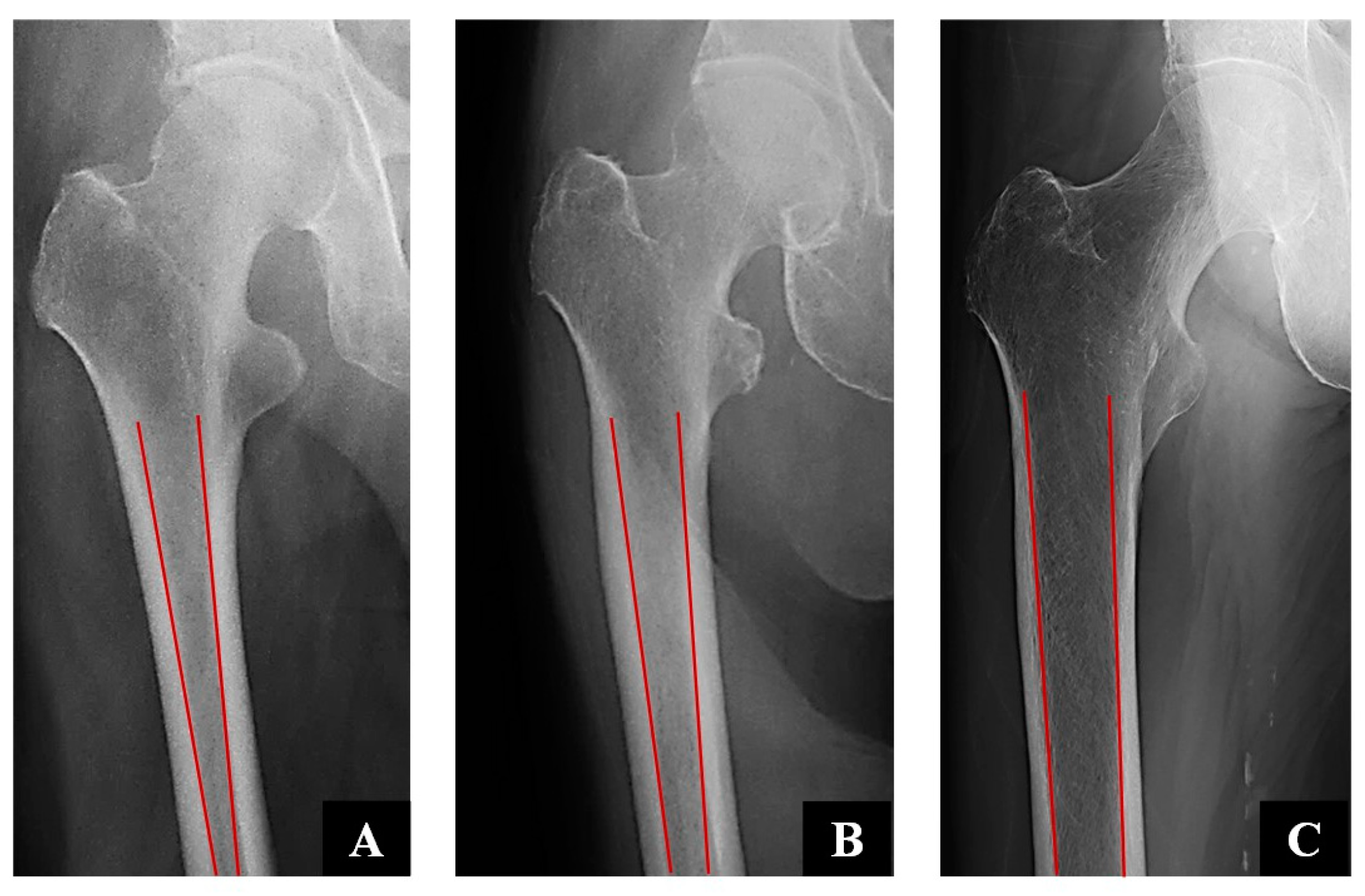 Osteology 05 00009 g003