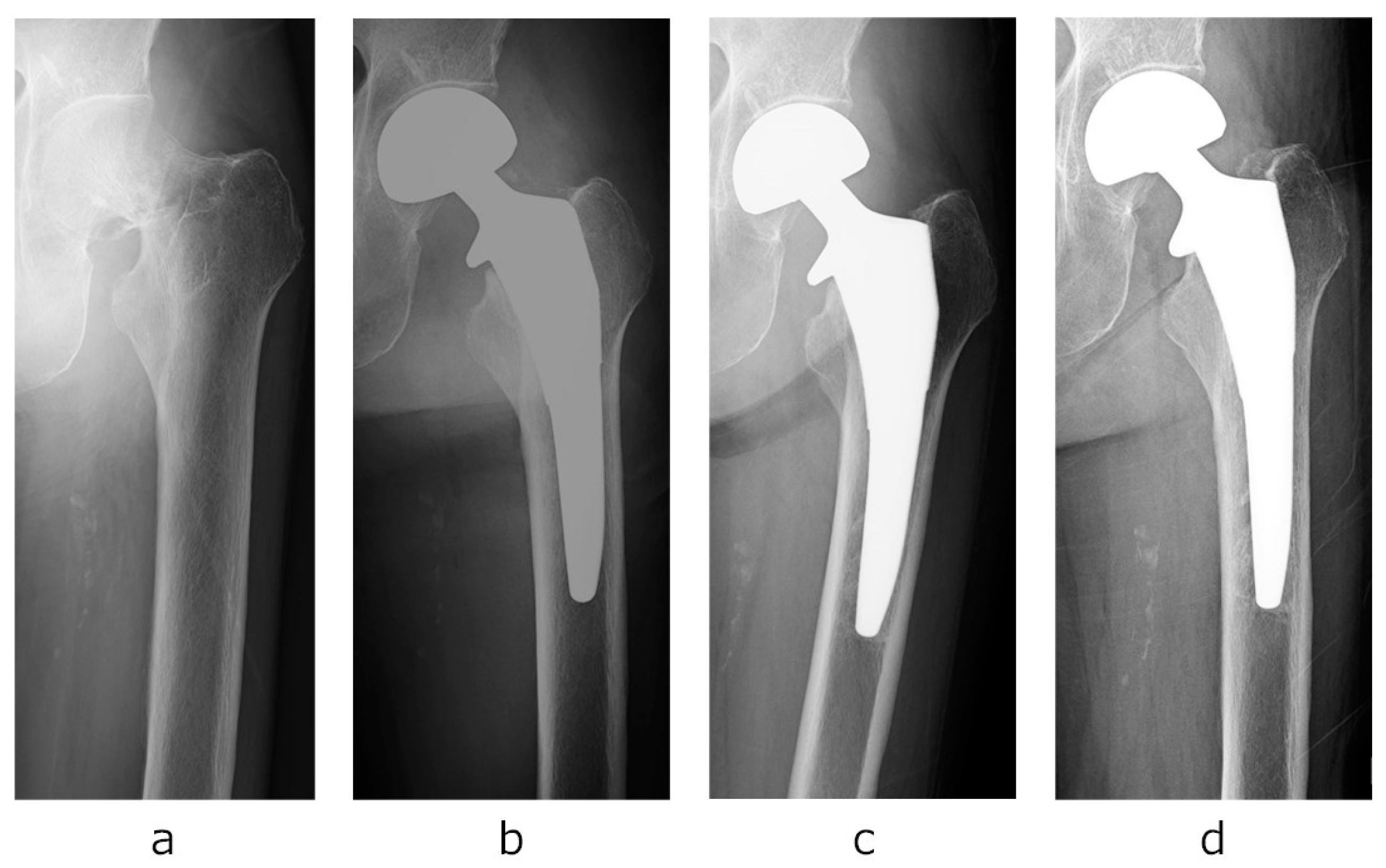 Osteology 05 00009 g005