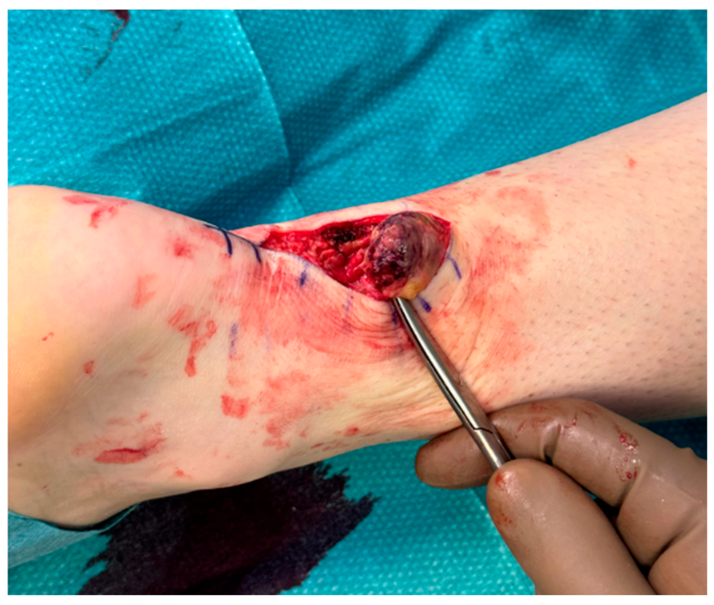 Osteology 05 00020 g002