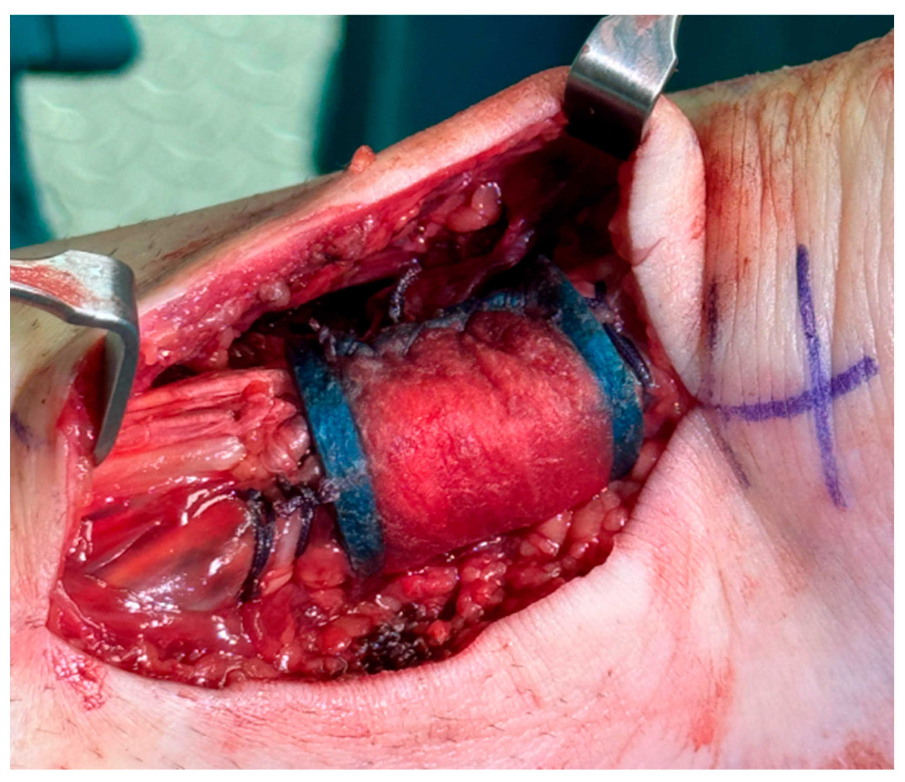 Osteology 05 00020 g004