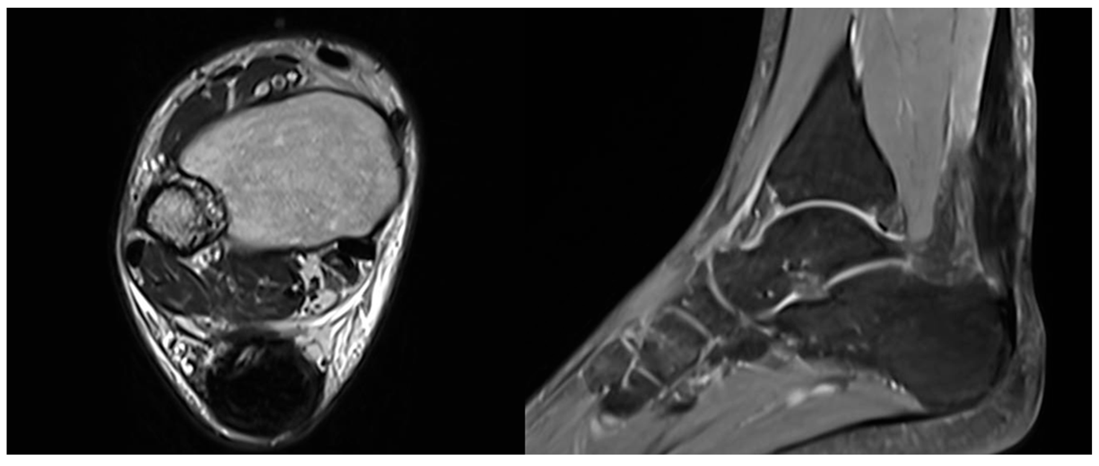 Osteology 05 00020 g005