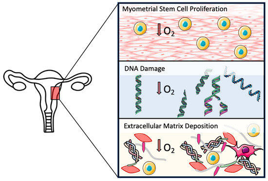Hypoxia in Uterine Fibroids: Role in Pathobiology and Therapeutic  Opportunities