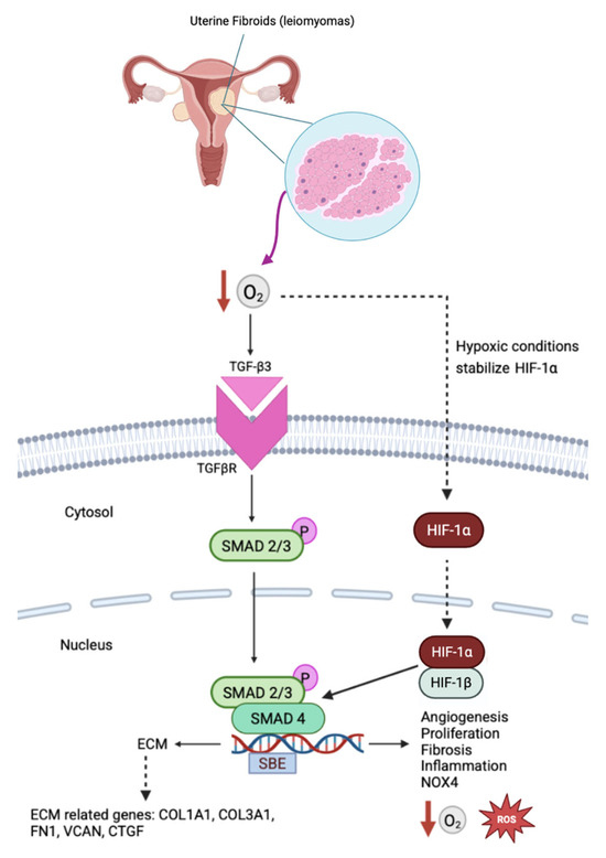 is glutathione good for fibroids HIF-1α Signaling in Uterine Fibroids: A Central Integrator of Hypoxic,  Hormonal, and Fibrotic Pathways