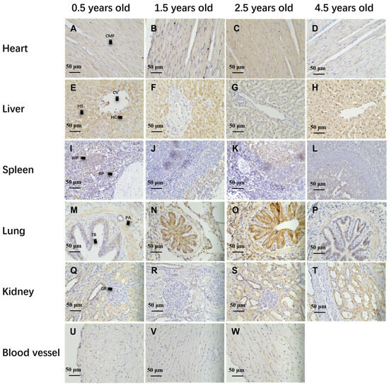 Age-Related Expression and Localization of HIF-1α and HIF-2α in