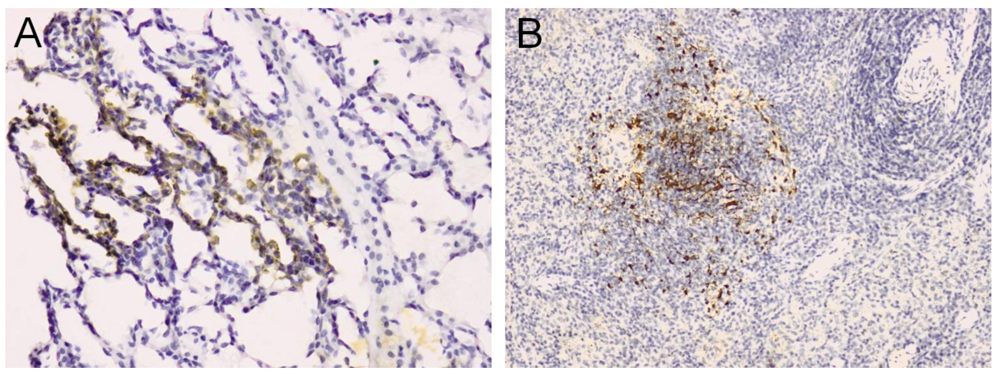 Pathogens 02 00264 g001 1024