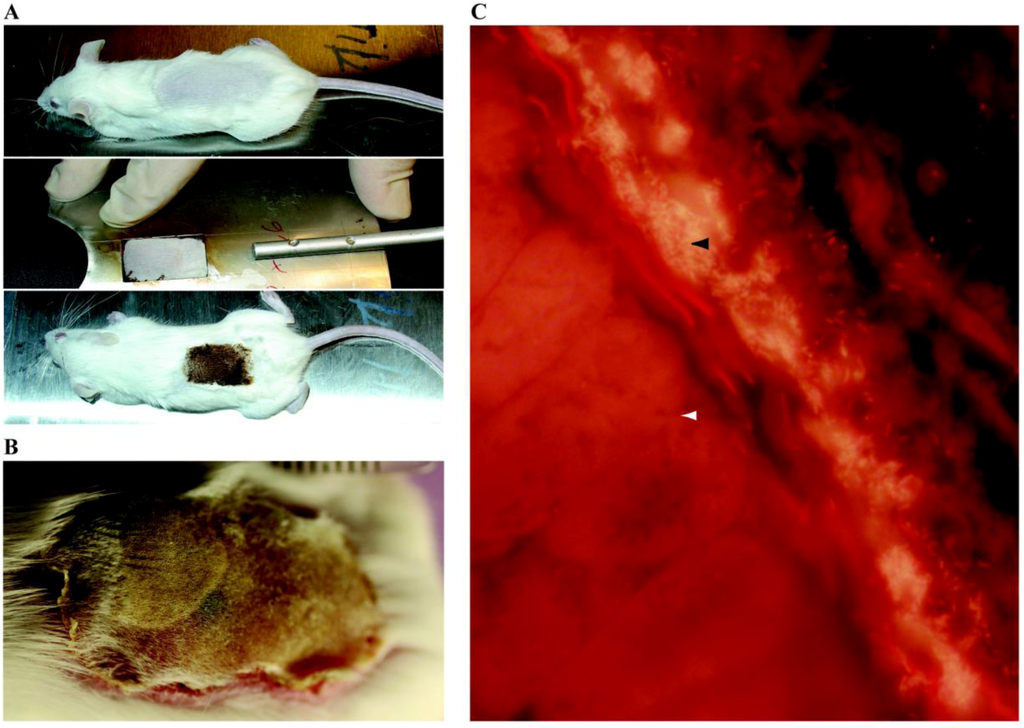 From in vitro to in vivo Models of Bacterial Biofilm-Related