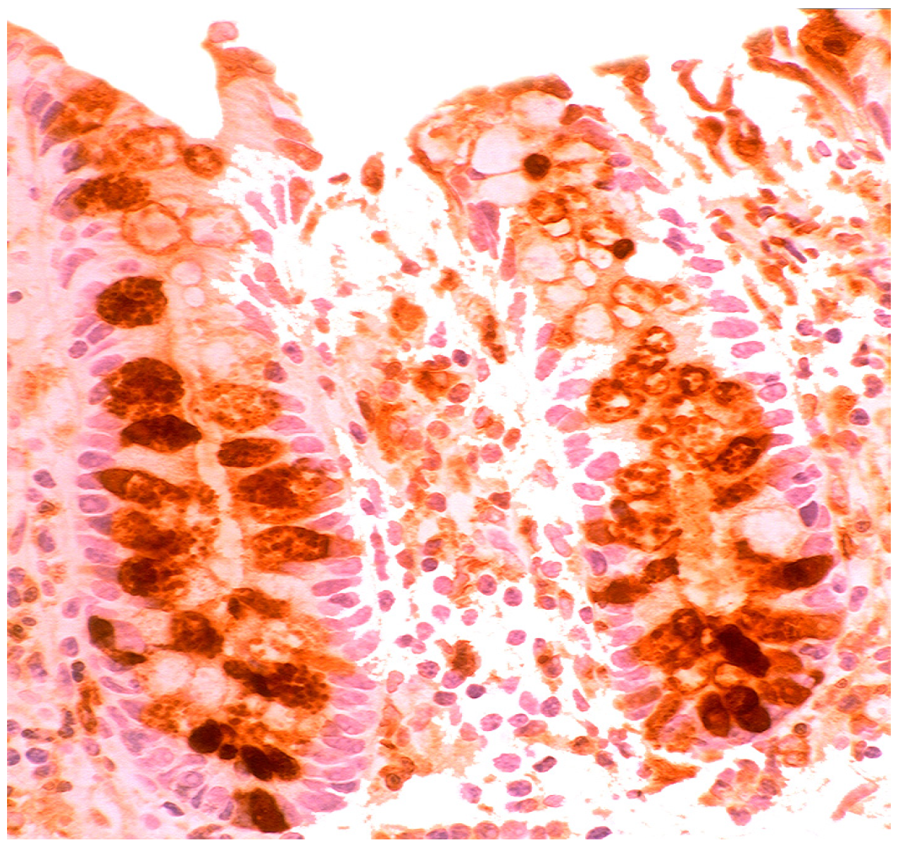 Pathogens 03 00073 g011