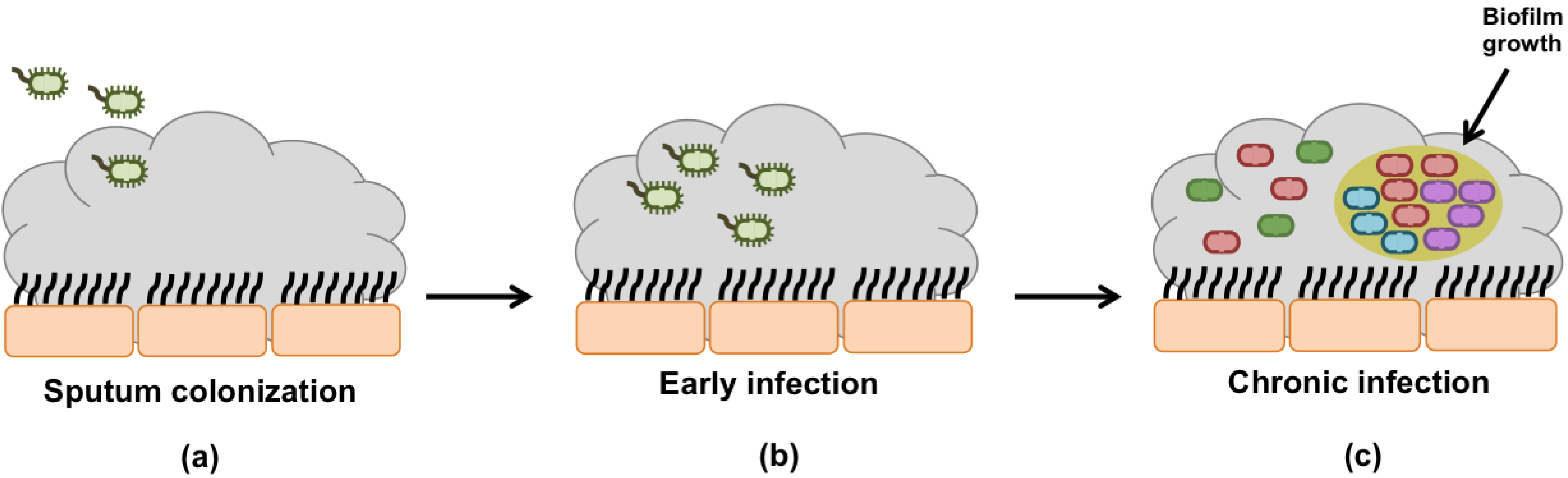 Biofilm inhibitory effect of alginate lyases on mucoid P. aeruginosa from a  cystic fibrosis patient - ScienceDirect