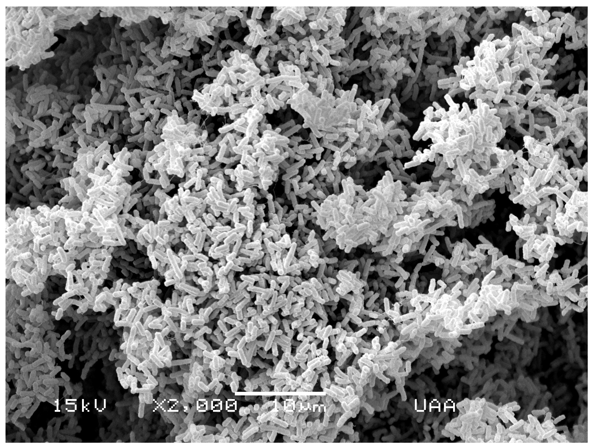 chef langs Piket Pathogens | Free Full-Text | Waterborne Pathogens: Detection Methods and  Challenges