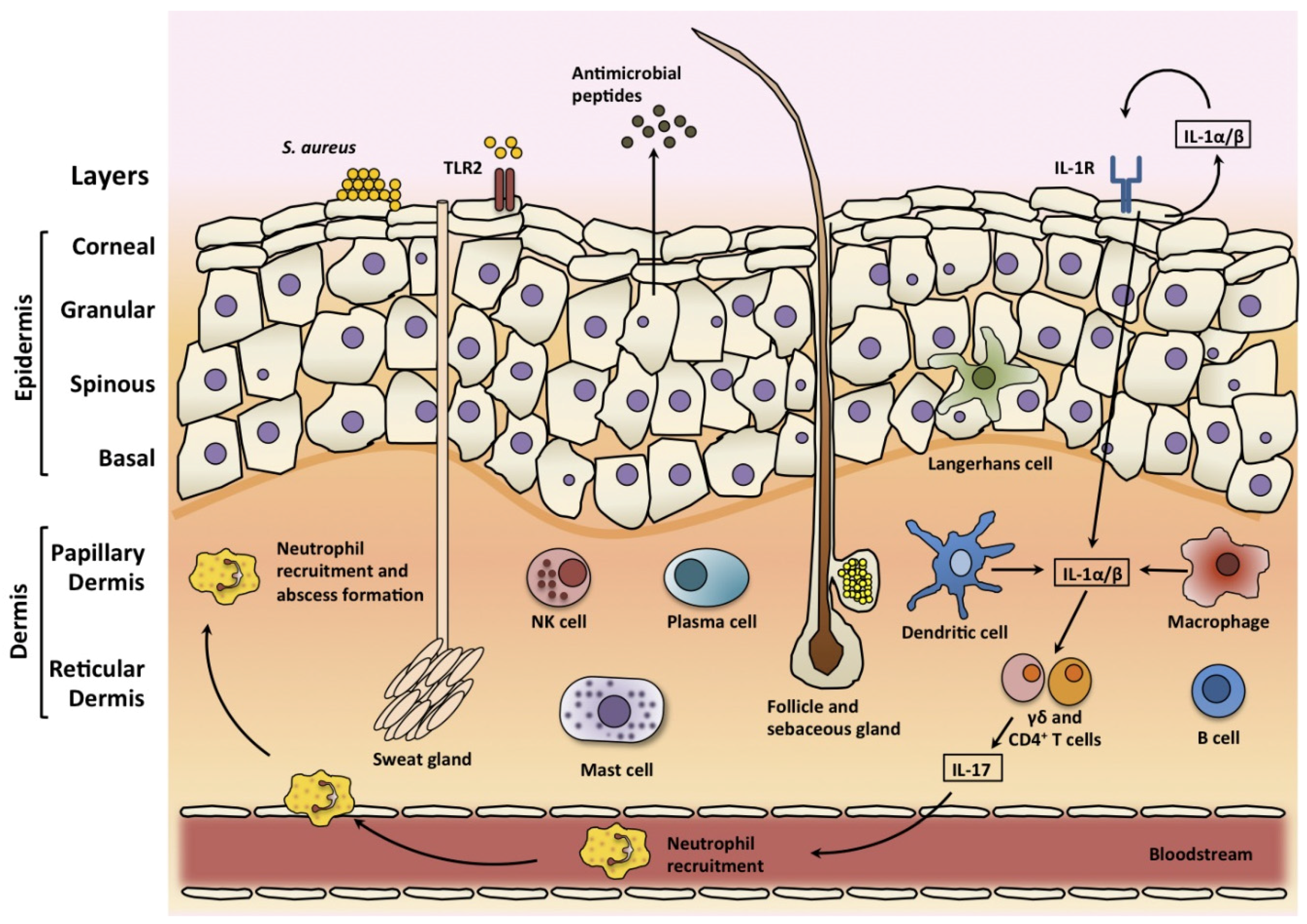 Staphylococcus aureus bacteria turns immune system against itself