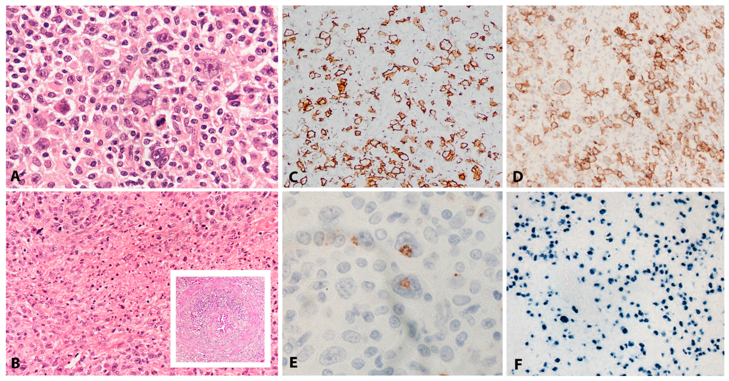 Pathogens 07 00028 g002 Pathogens 07 00028 g002