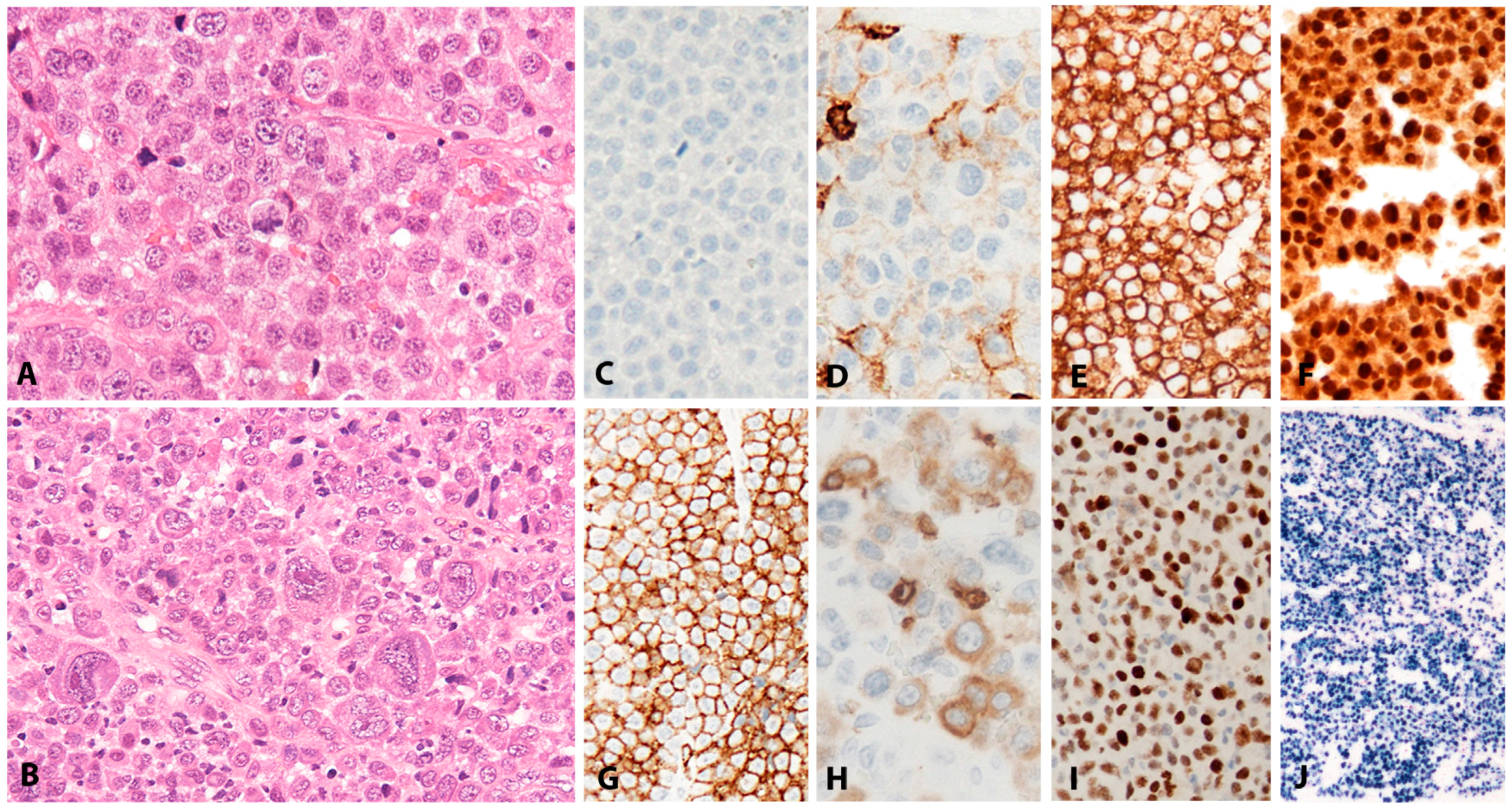 Pathogens 07 00028 g006 Pathogens 07 00028 g006