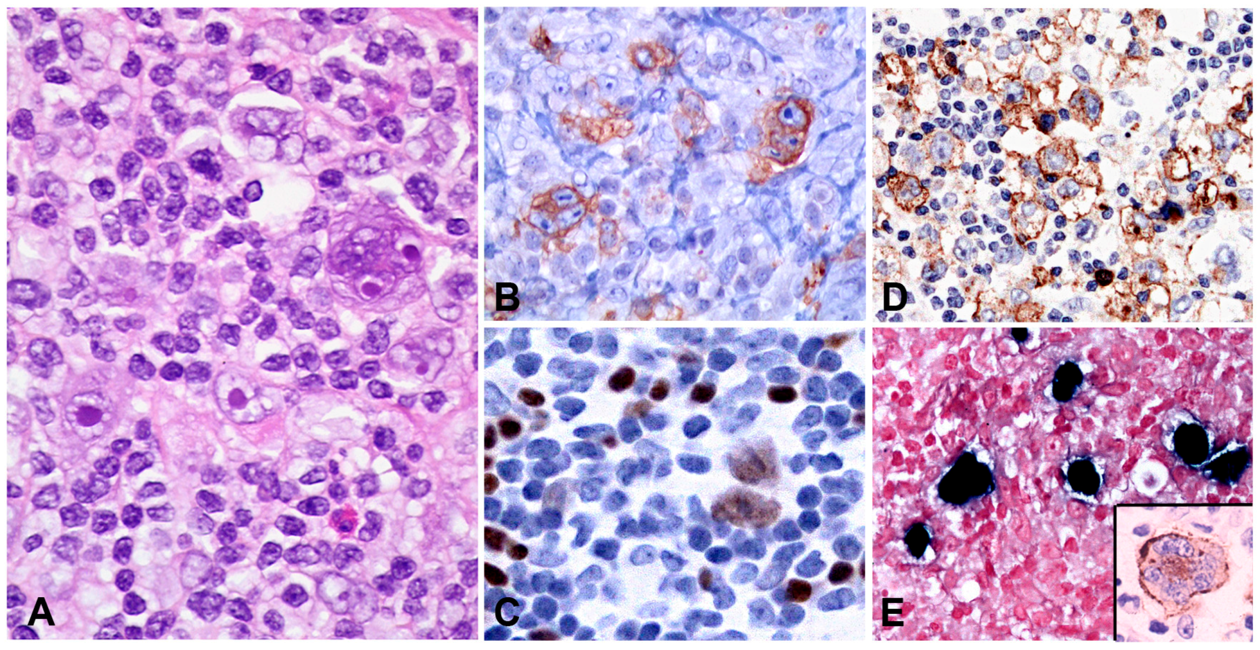 Pathogens 07 00028 g008 Pathogens 07 00028 g008