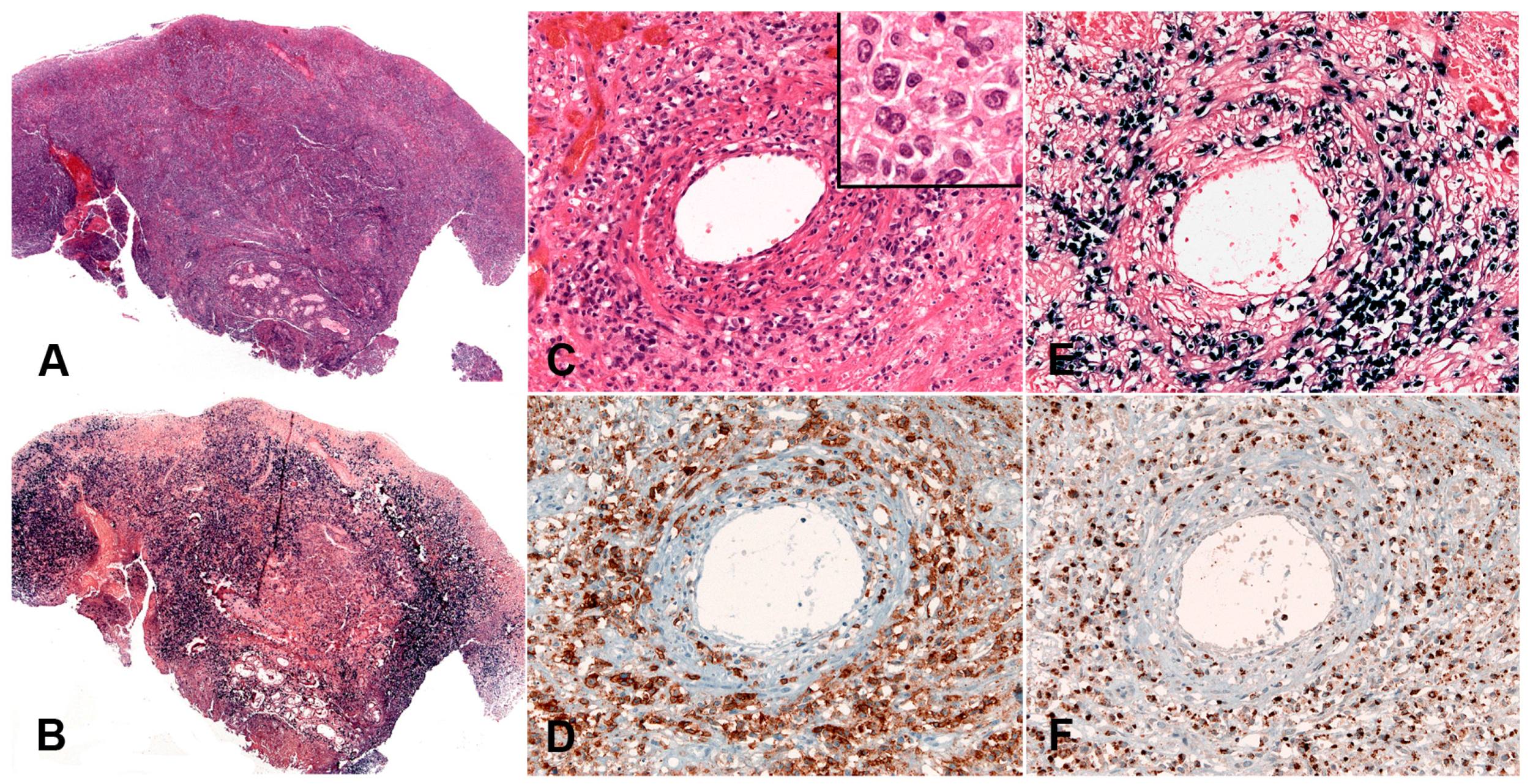 Pathogens 07 00028 g012 Pathogens 07 00028 g012