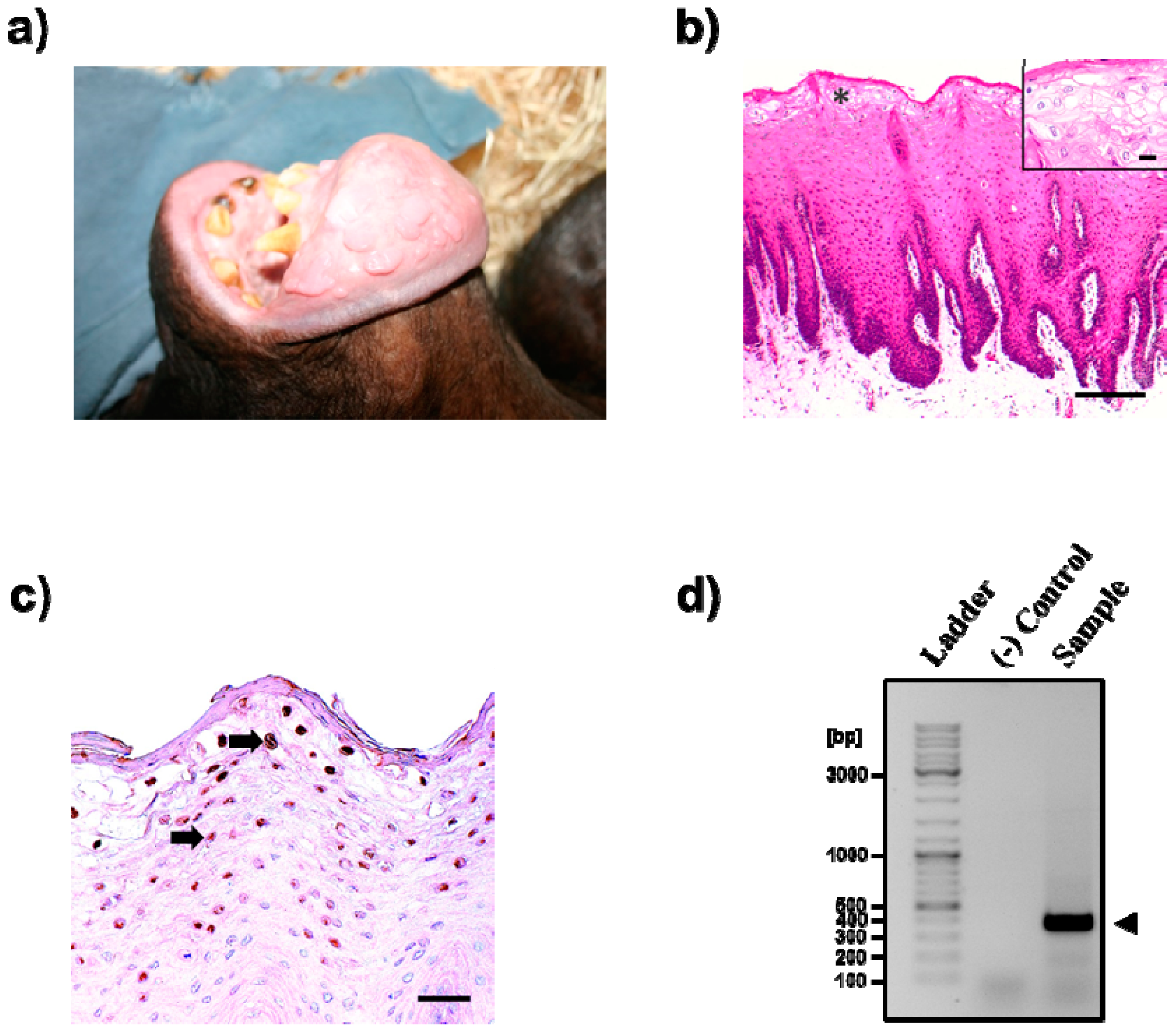 papilloma vírus hiperplázia biomágneses pár a pinwormok számára