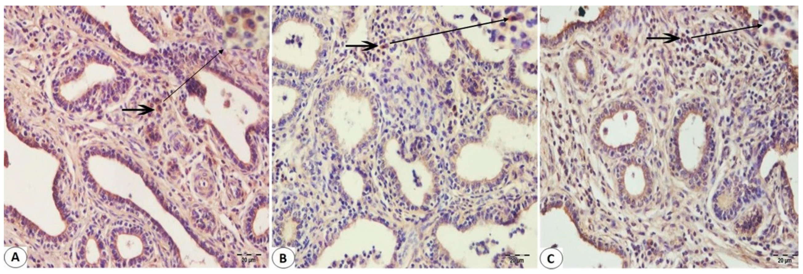 parainfluenza type 3 parainfluenza type 3