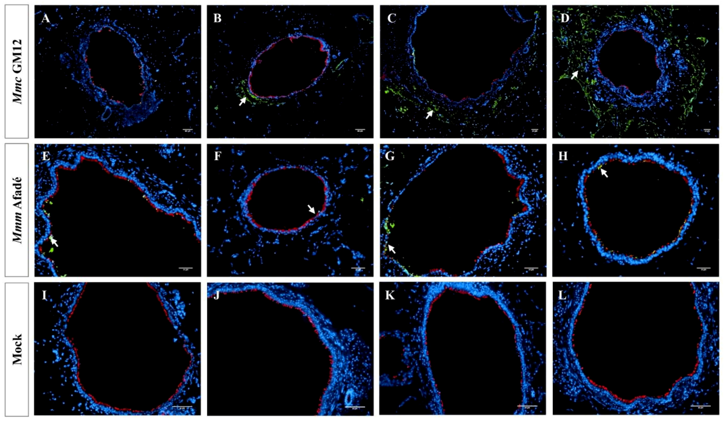 Pathogens Free Full Text Host Pathogen Interactions Of Mycoplasma Mycoides In Caprine And Bovine Precision Cut Lung Slices Pcls Models Html