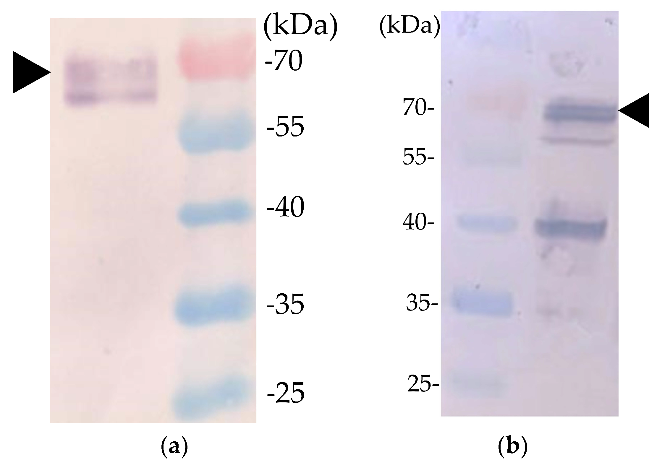 Pathogens 08 00262 g003 Pathogens 08 00262 g003
