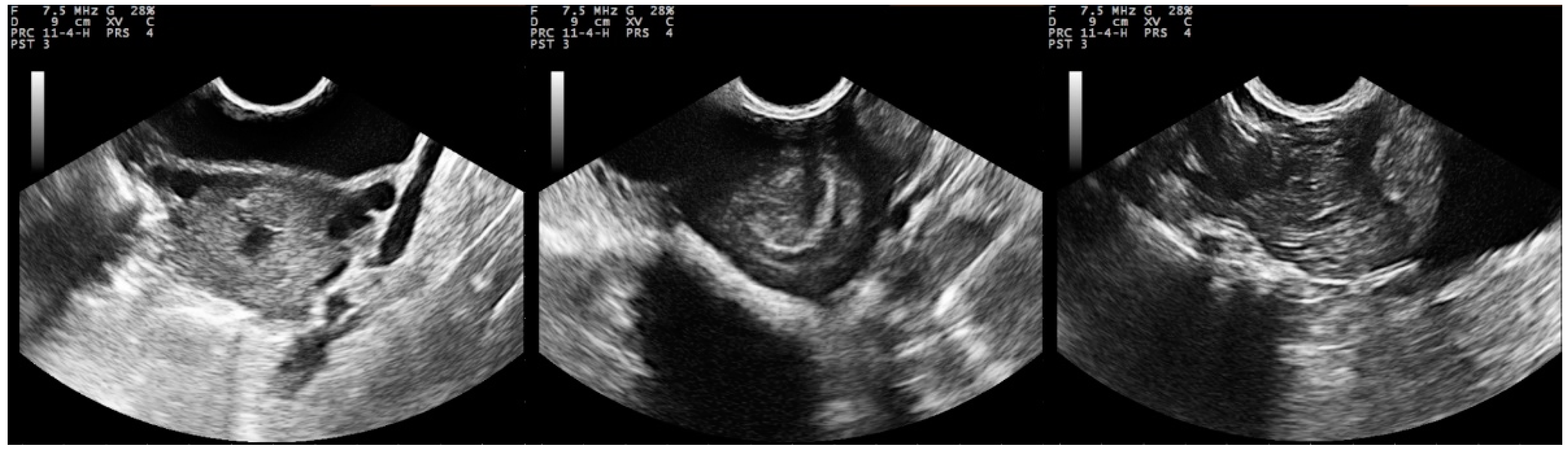 Pathogens Free FullText Clinical, Ultrasonographic, Bacteriological, Cytological and